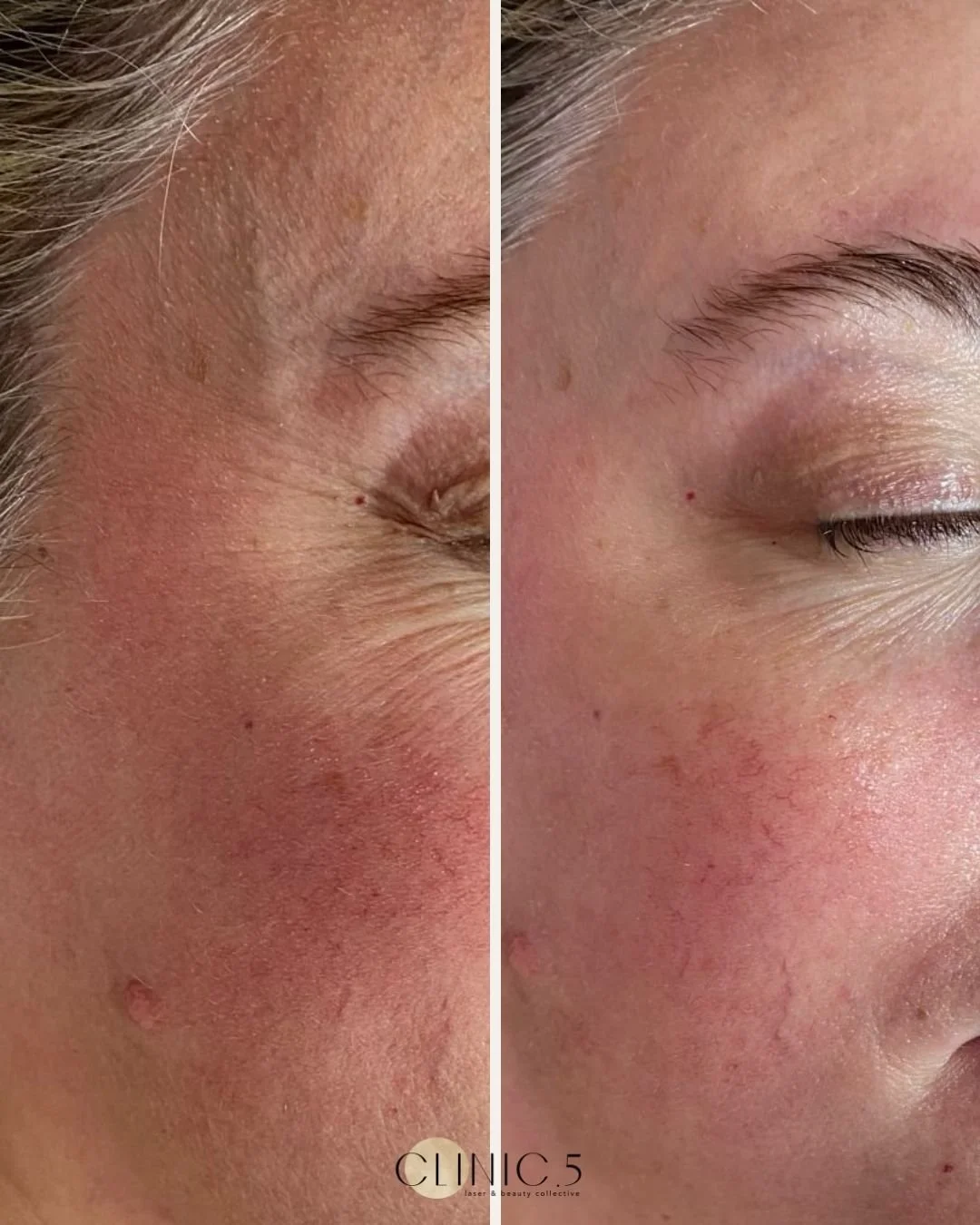 Clinic 5 Transformation (red light 4).jpg
