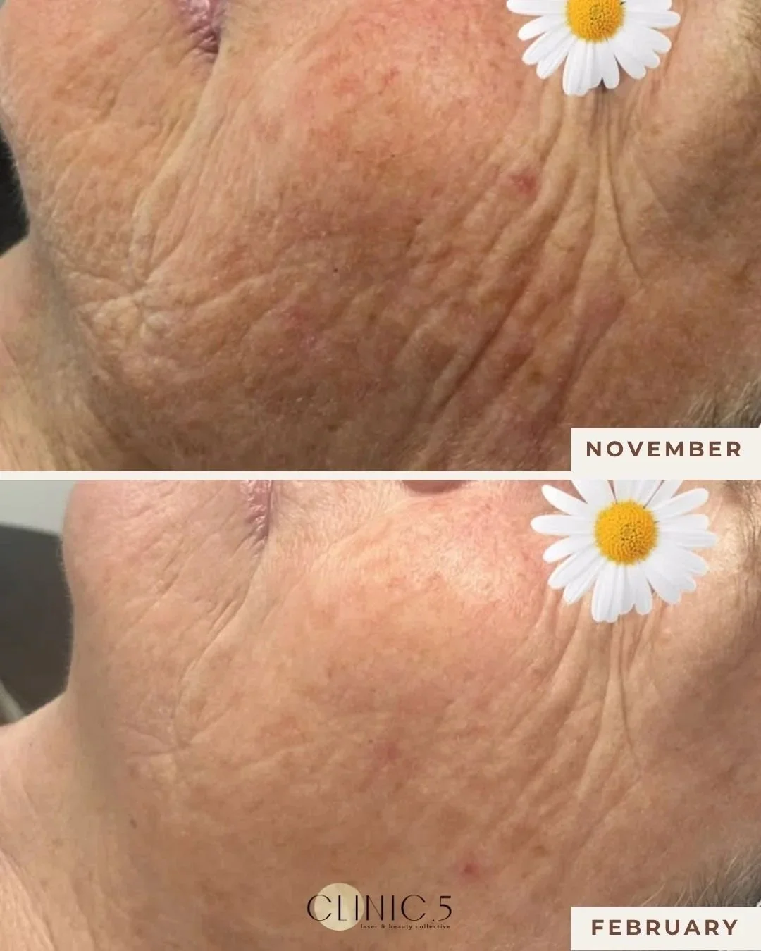 Clinic+5+Transformation+%28red+light%29.jpg