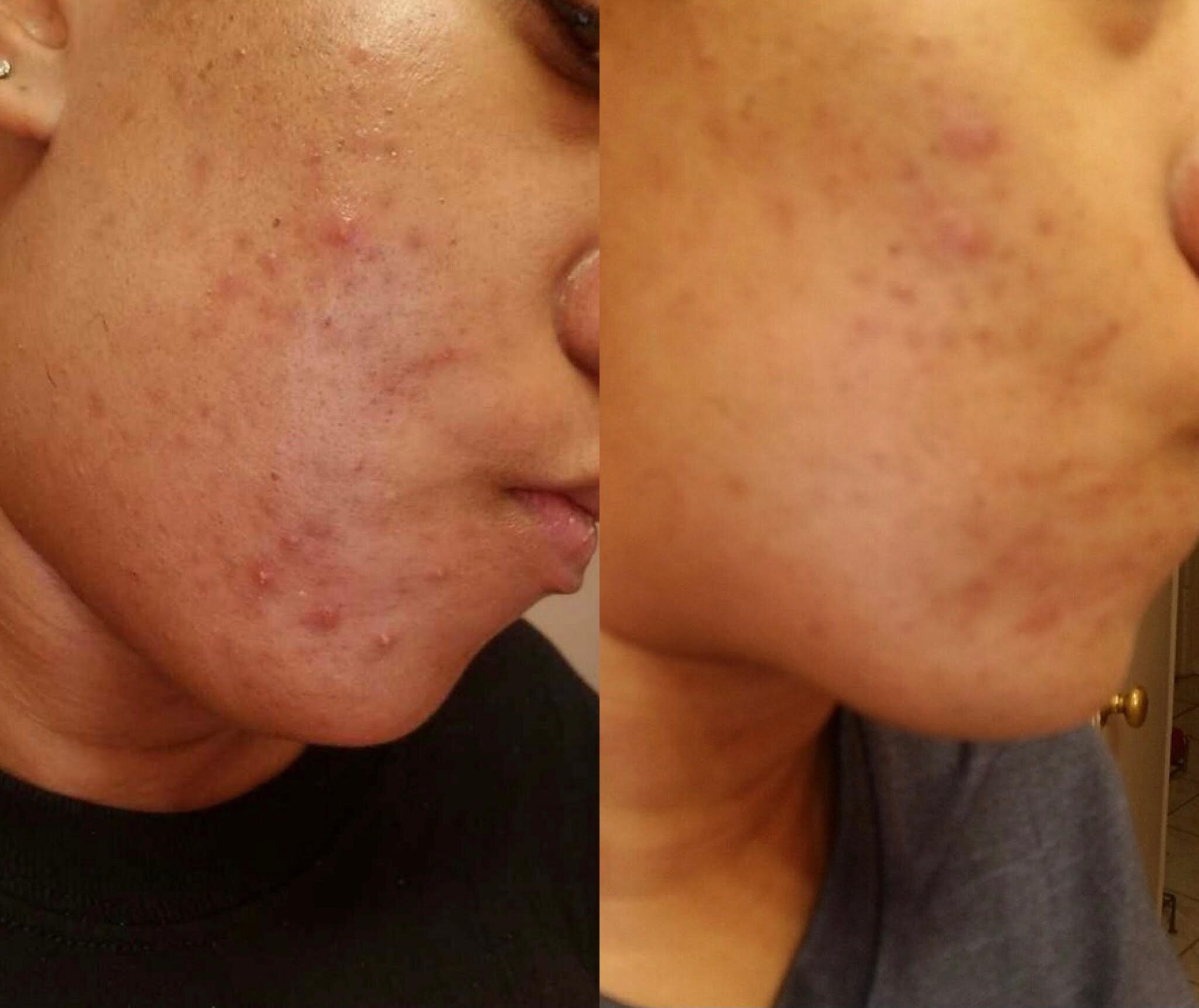 Gallery — Aesthetic Laser & Skin Care