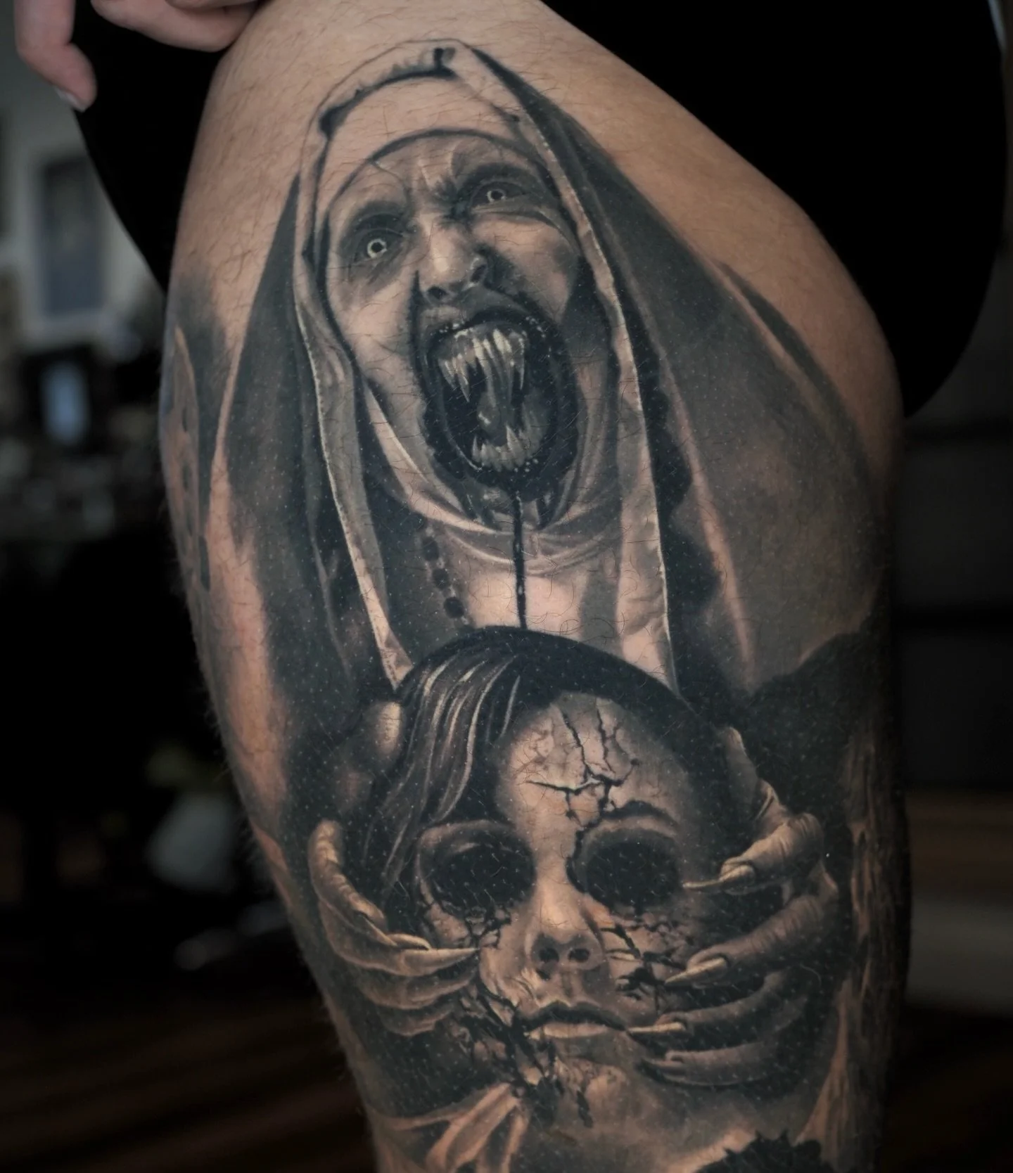 Healed Nun. Healed about 2-3 years.