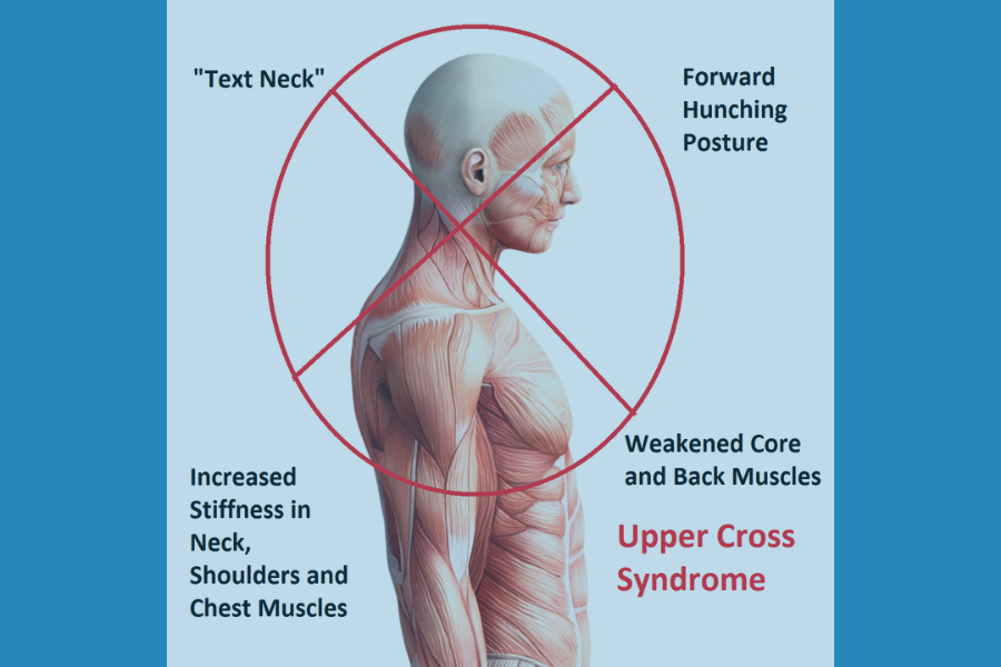 Dealing with Upper Cross Syndrome/Text Neck