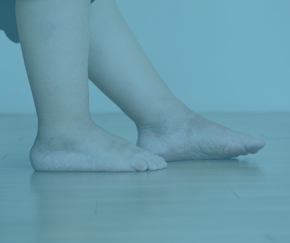 Is This Really Just Fat OR is it Lipedema?