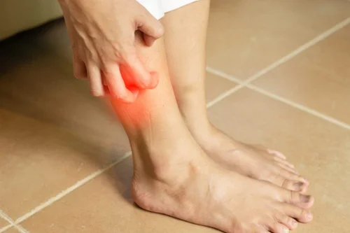 Health Tips: 5 સંકેતોથી ચેતજો, નાની ઉંમરે નસો બ્લોક થવાની સમસ્યા? 2 Varicose Veins Specialist in Naples, FL | Naples Cardiac & Endovascular Center