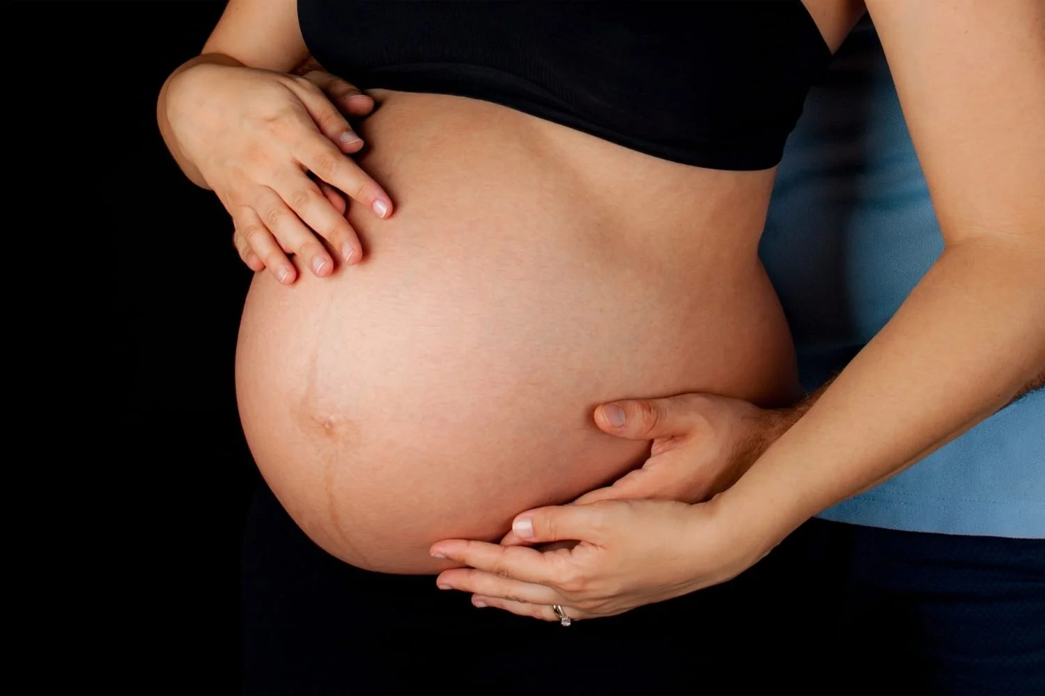 Varicose Veins During Pregnancy Naples Cardiac & Endovascular Center