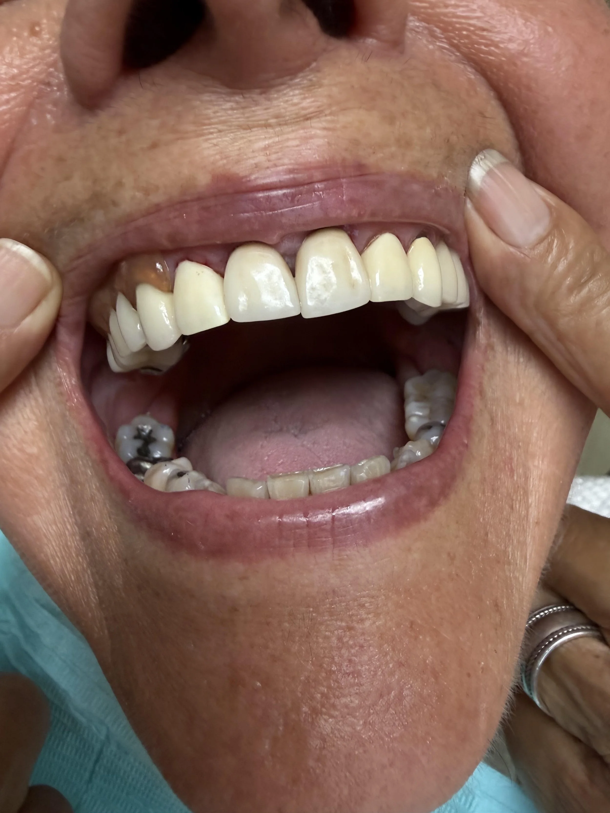 After Cosmetic Surgery 