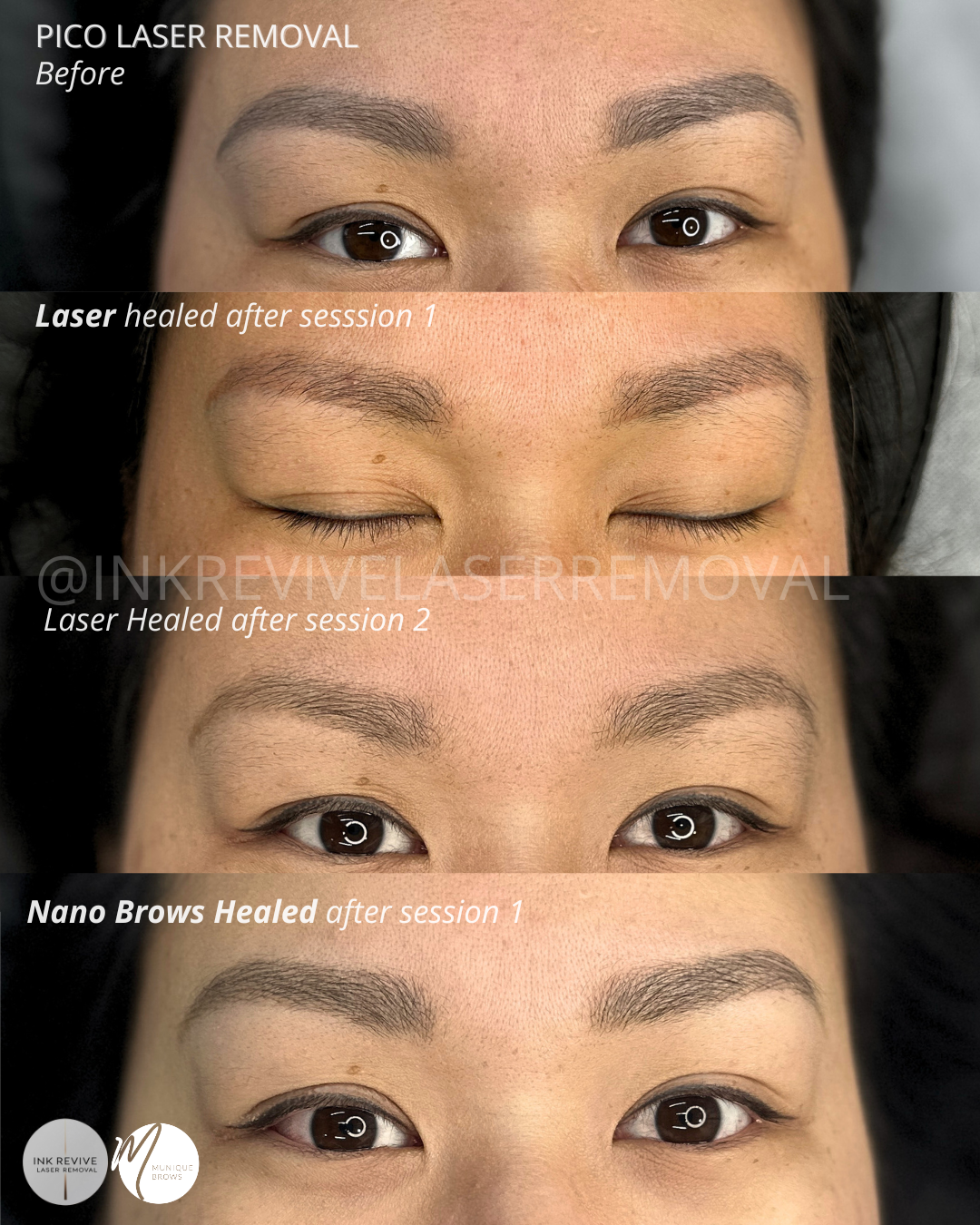 Embracing the Soft Girl Era — Again