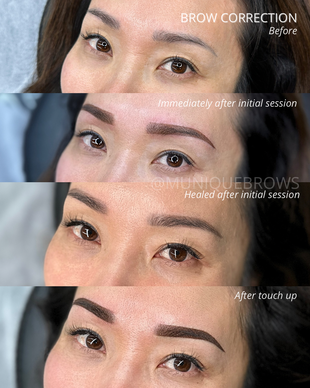 The Art of the Fix: When Can We Correct Faded Brows vs. When Do We Need Removal?