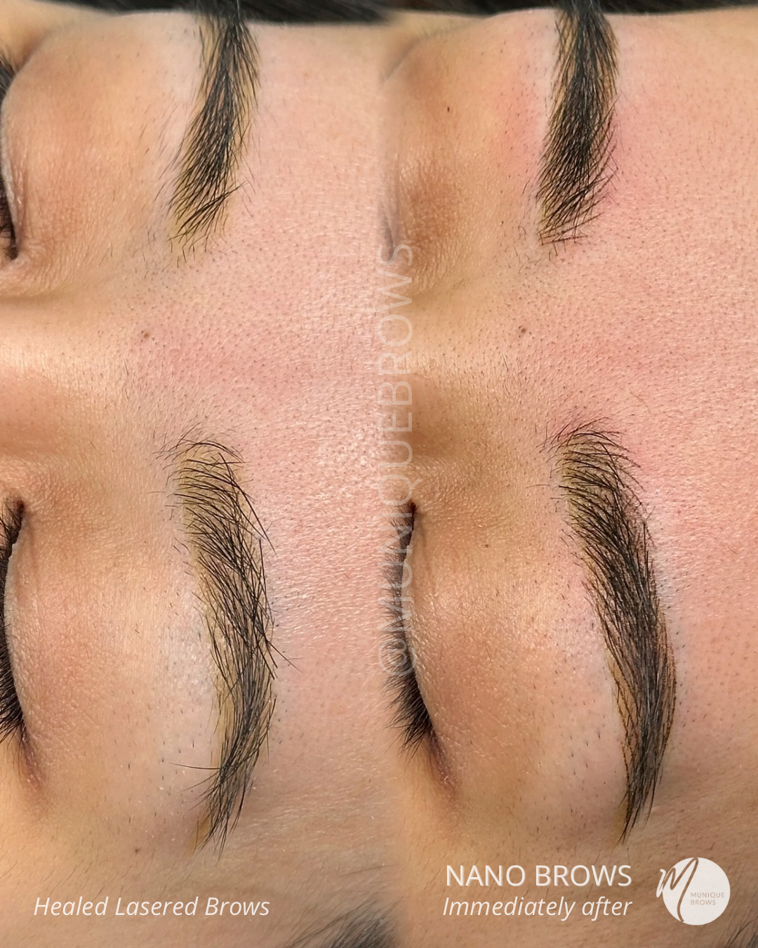 Copy of Brow correction Kitty - 1.png