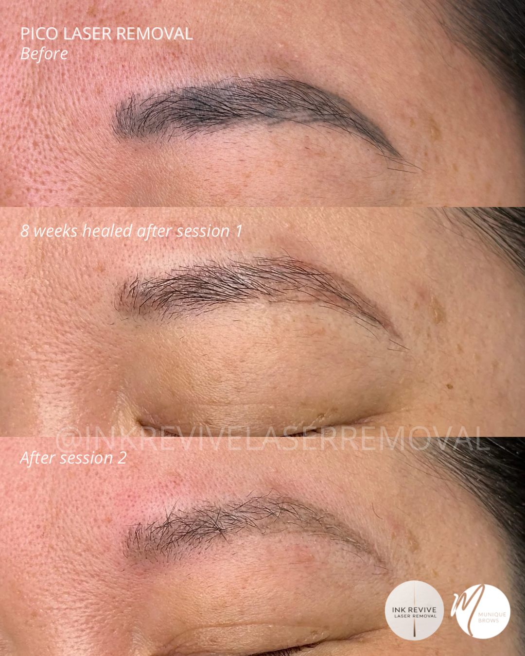 Turning "Deep Blue" Back to Beautiful: A Brow Rescue at Munique Brows Studio