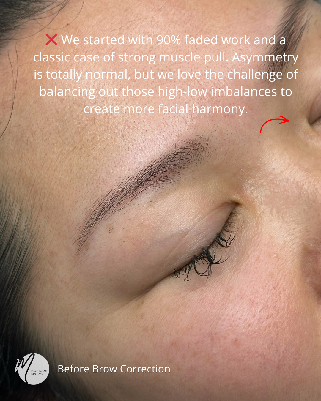 Brow Correction Sam - 3.png
