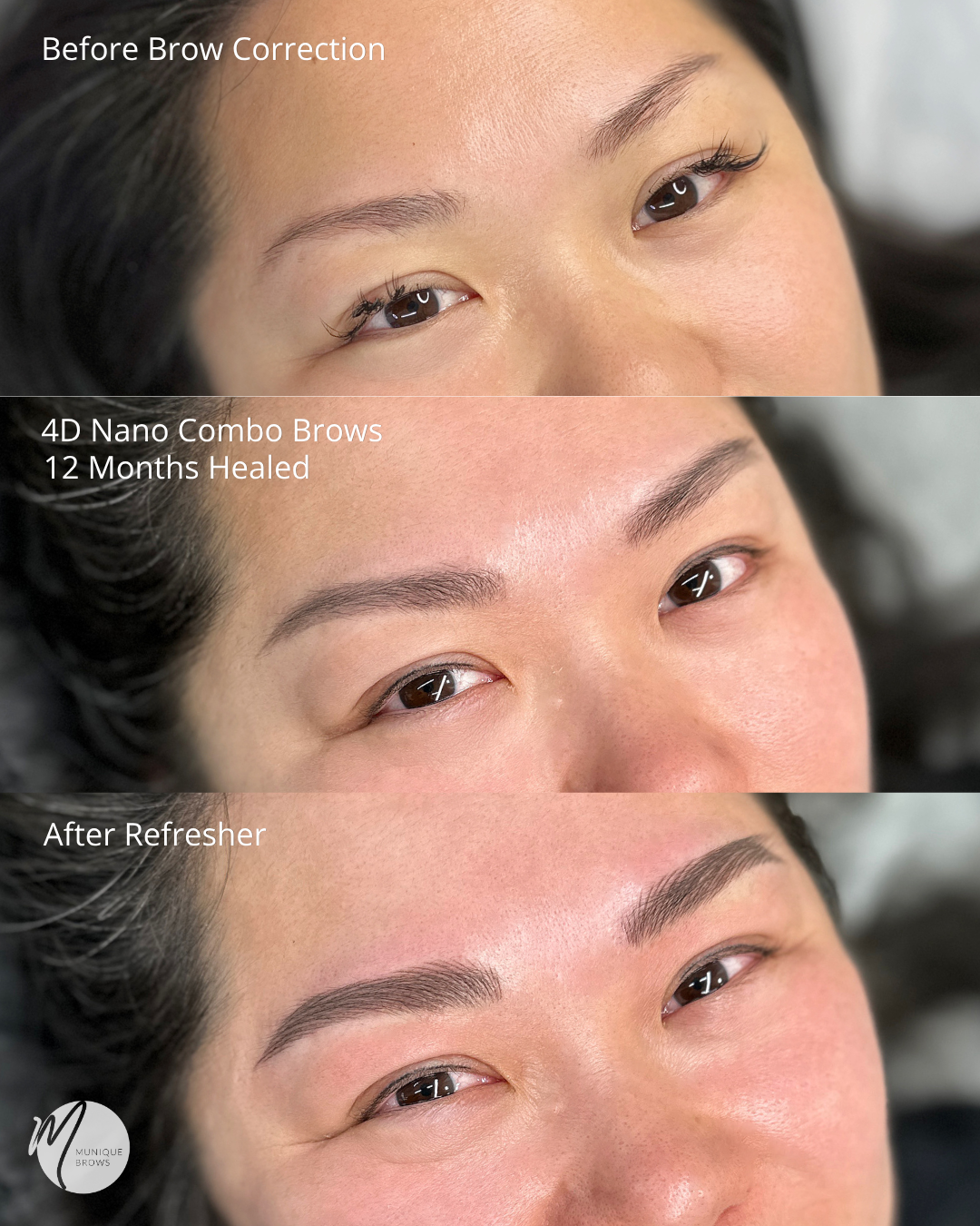 Brow Correction Sam - 4.png