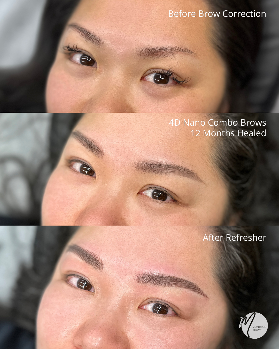 Brow Correction Sam - 5.png