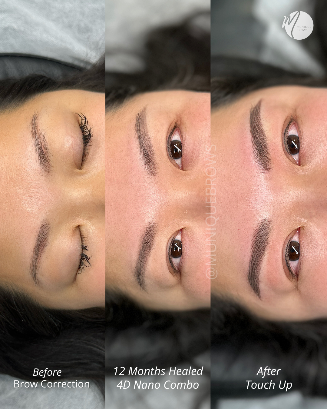 Brow Correction Sam - 6.png