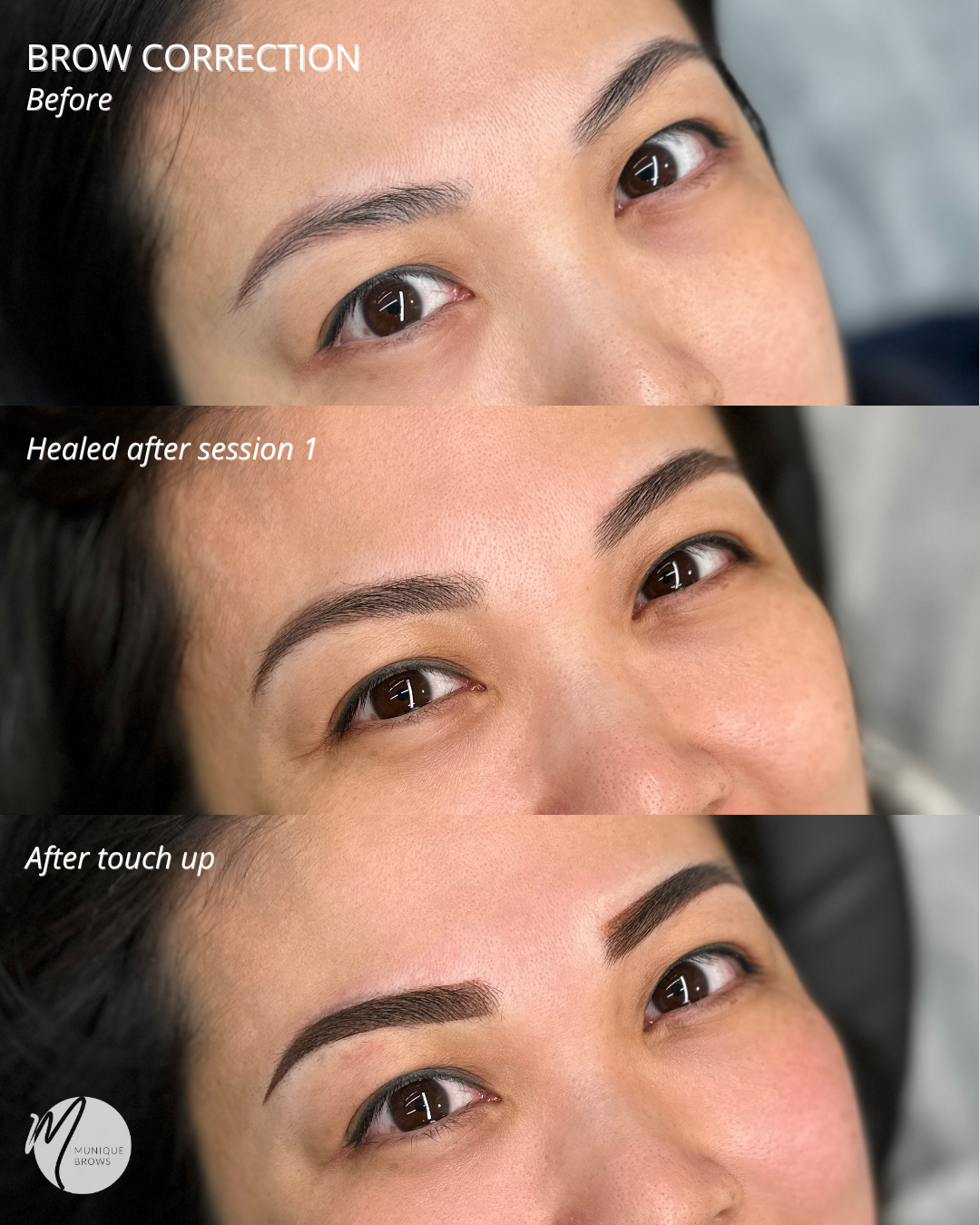 This brow was thicker than the other - 11.png