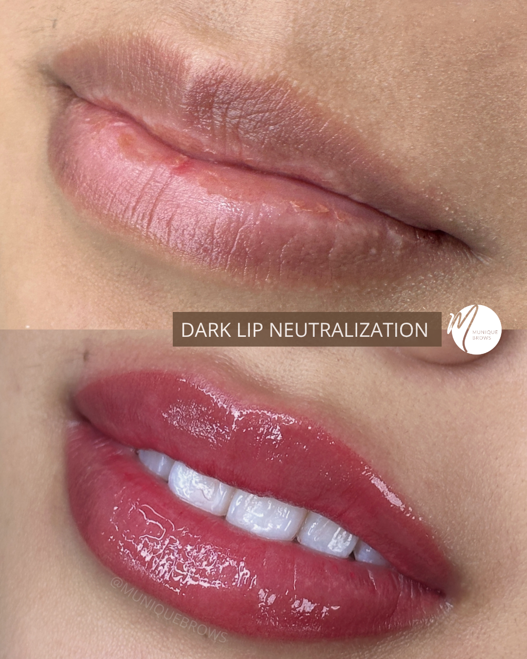 DARK LIP NEUTRALIZATION (1).png