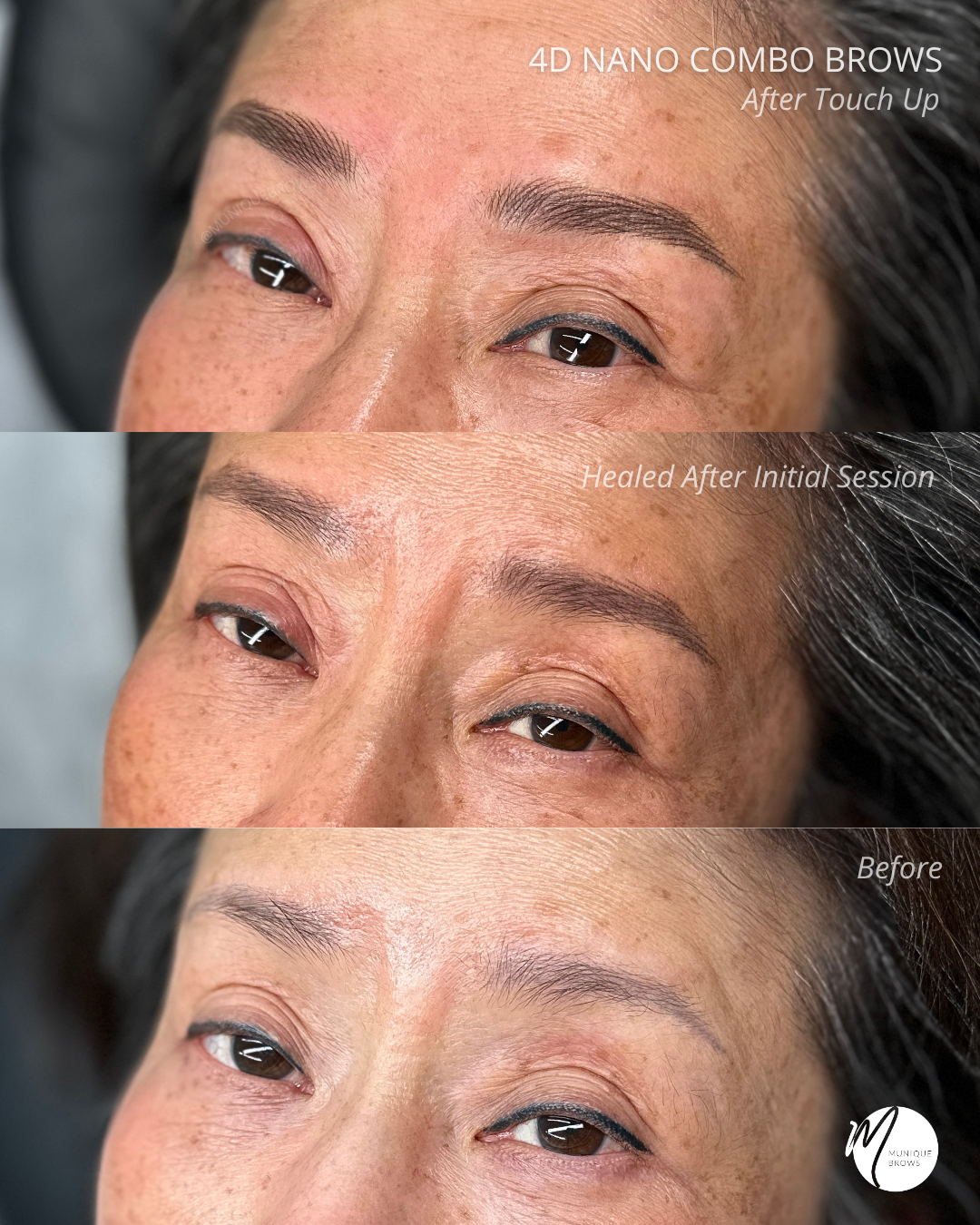 From a 2-Decade-Old Tattoo to Euro-Trip Ready: A Stunning Brow Correction Story