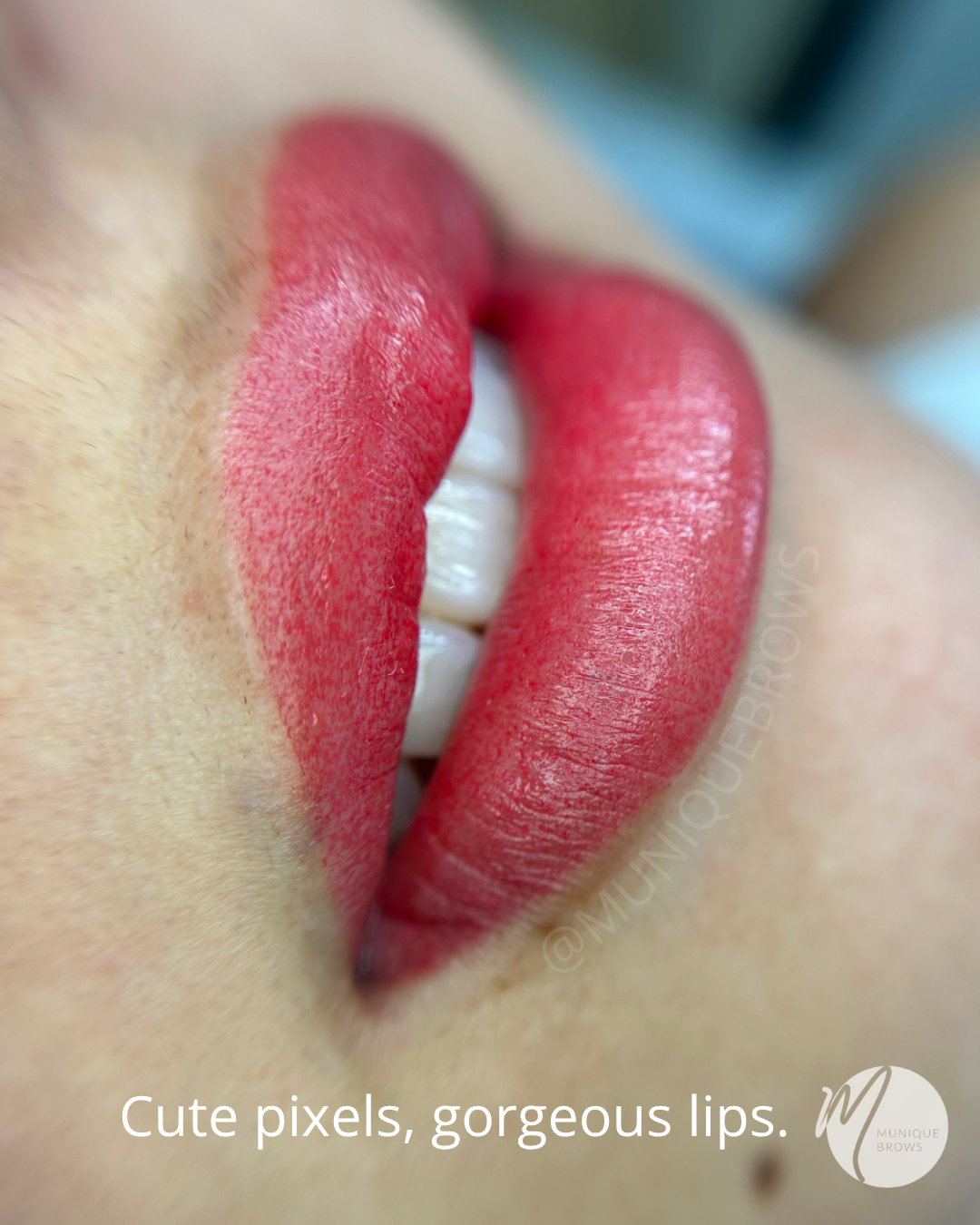 Lip Blush Neutralization: Fix Lip Discoloration &amp; Restore Shape
