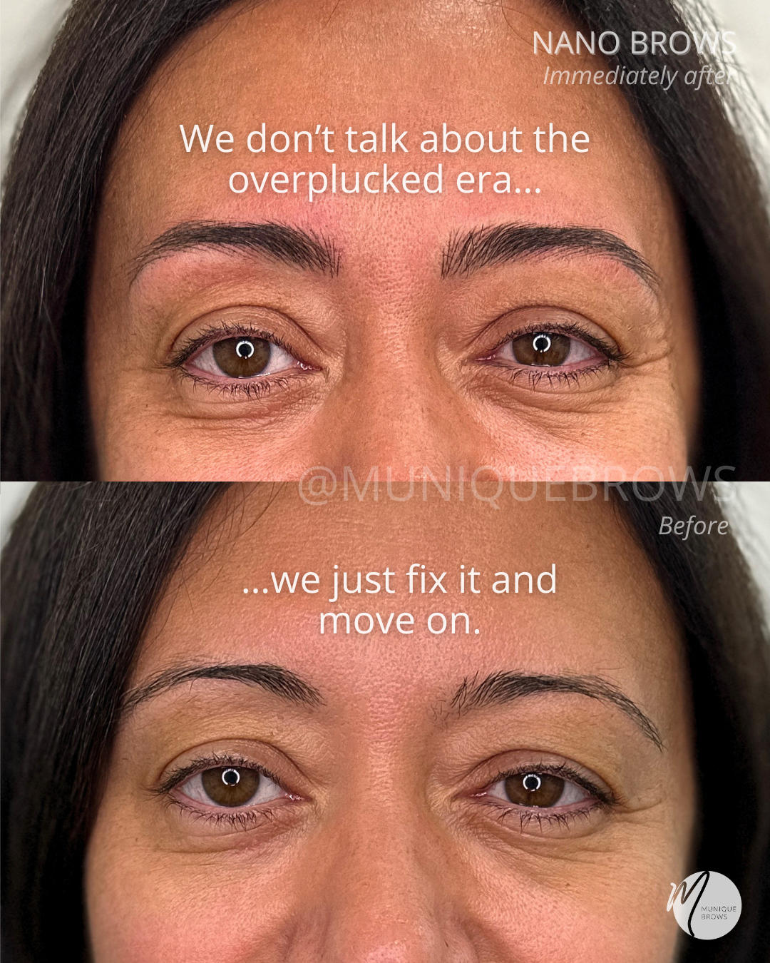 Overplucked to Effortless: How Nano Brows Completely Transformed Her Face (Without Looking "Done")