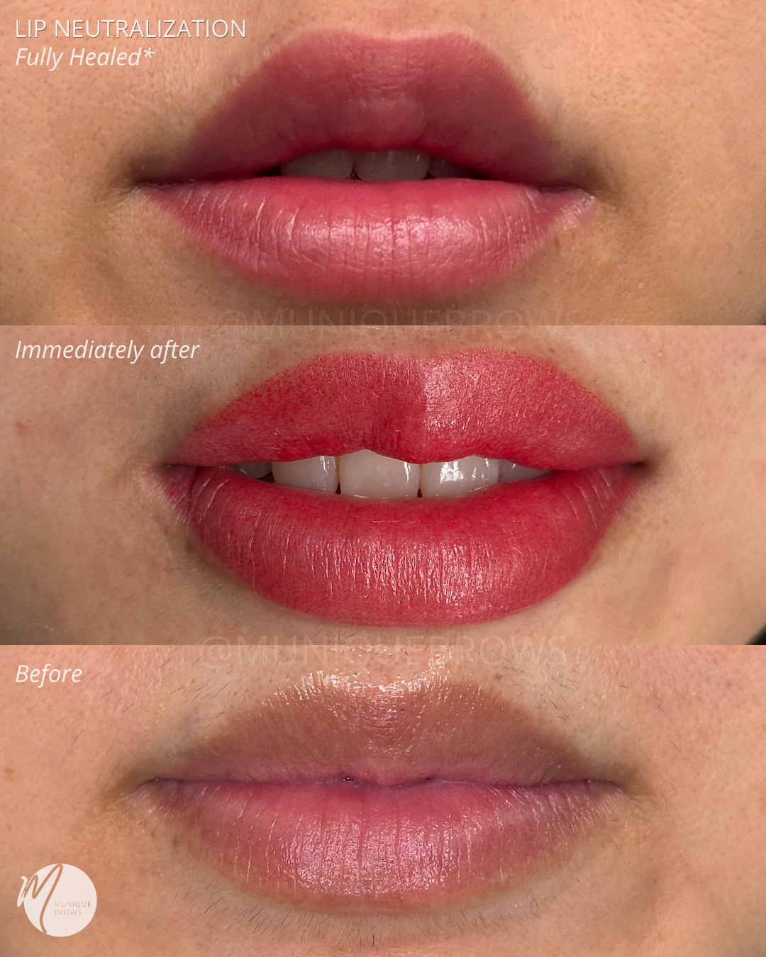 The Ultimate Lip Neutralization Transformation: From Brown Tones to Warm Blush