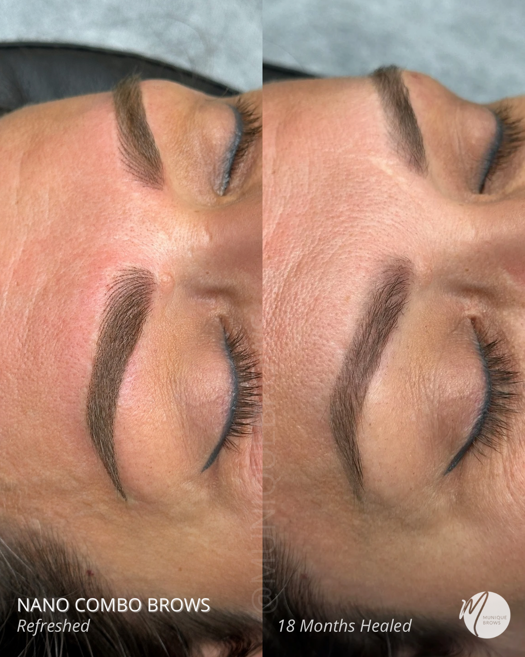 Copy of Nano combo brows JK - 3.png