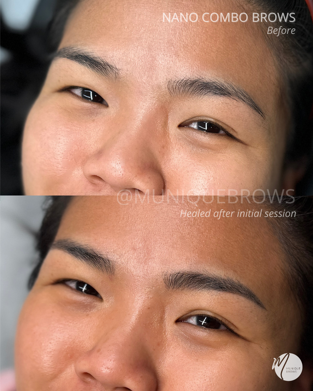 Achieving Brow Symmetry with Nano Combo Brows | Munique Brows