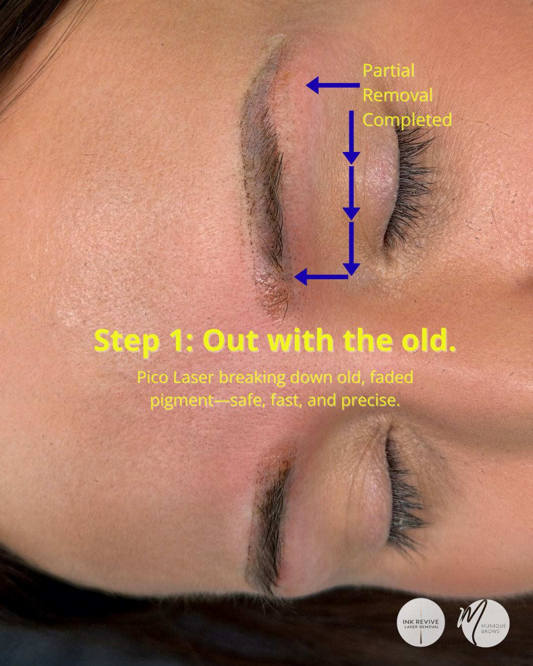 Faded Ashy Grey-Blue &amp; Red Microblading? Here is How We Achieved a Soft, Balanced Brow Correction