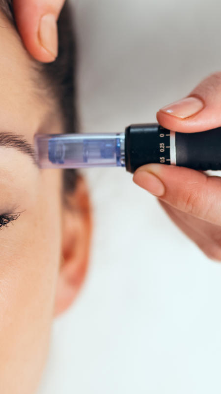dermapen-microneedling-Facial-Basngstoke-450x800.png