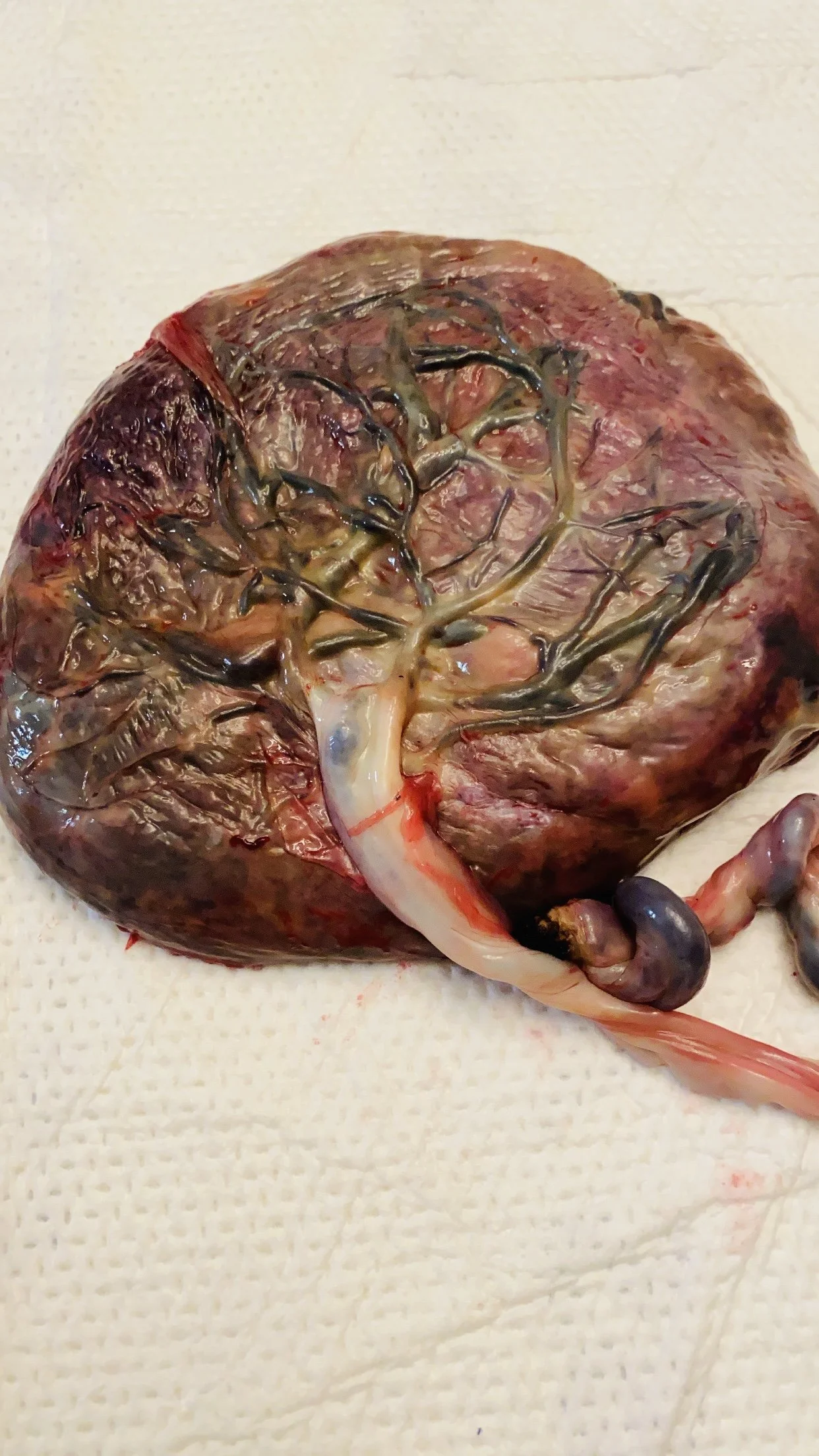 zig placenta.jpg