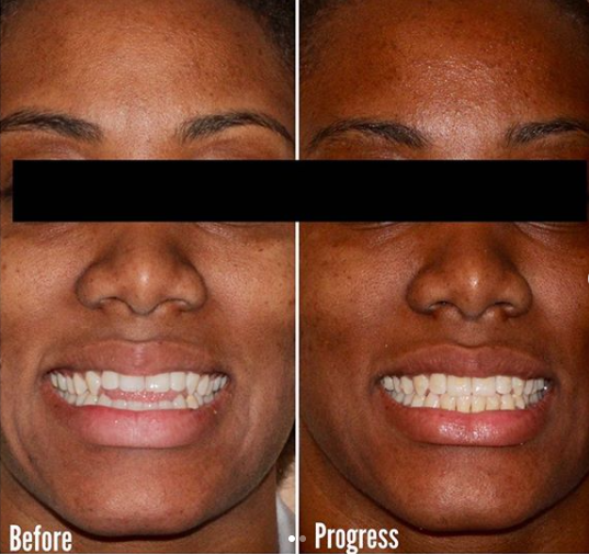 Our patients walk away satisfied. But don’t listen to us. See for