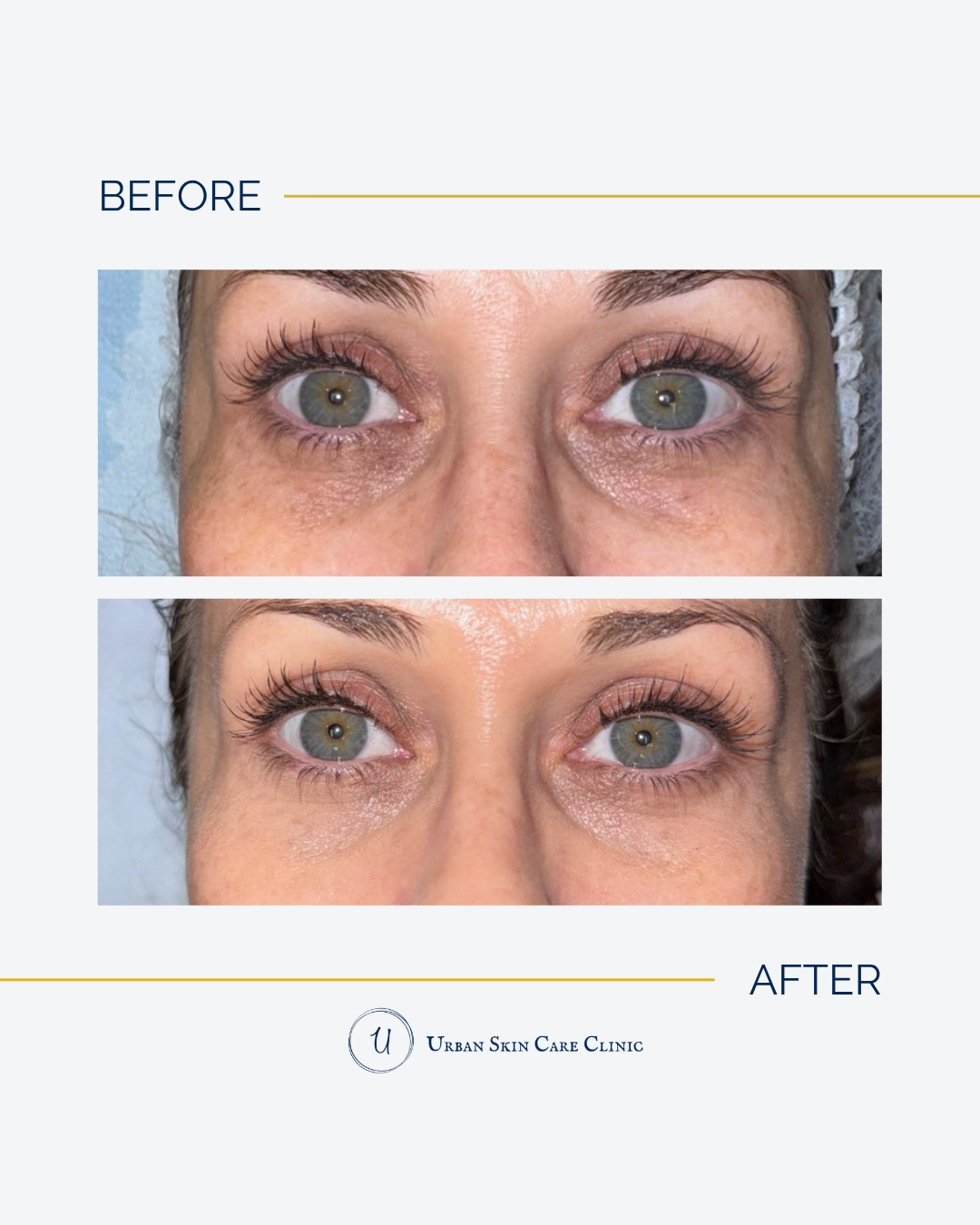 The Six‑Week Holiday Glow Plan: Start in October and Look Radiant by Thanksgiving in Roswell, GA.