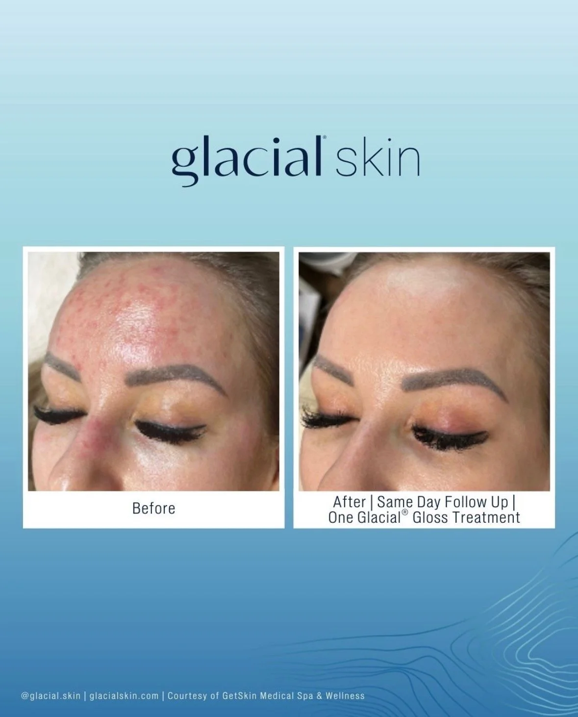 5 Things You Need to Know About Skin Inflammation