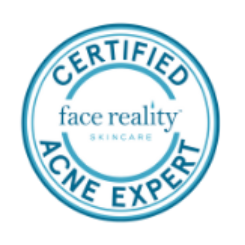 How To Remove Dark Spots? — Urban Skin Care Clinic