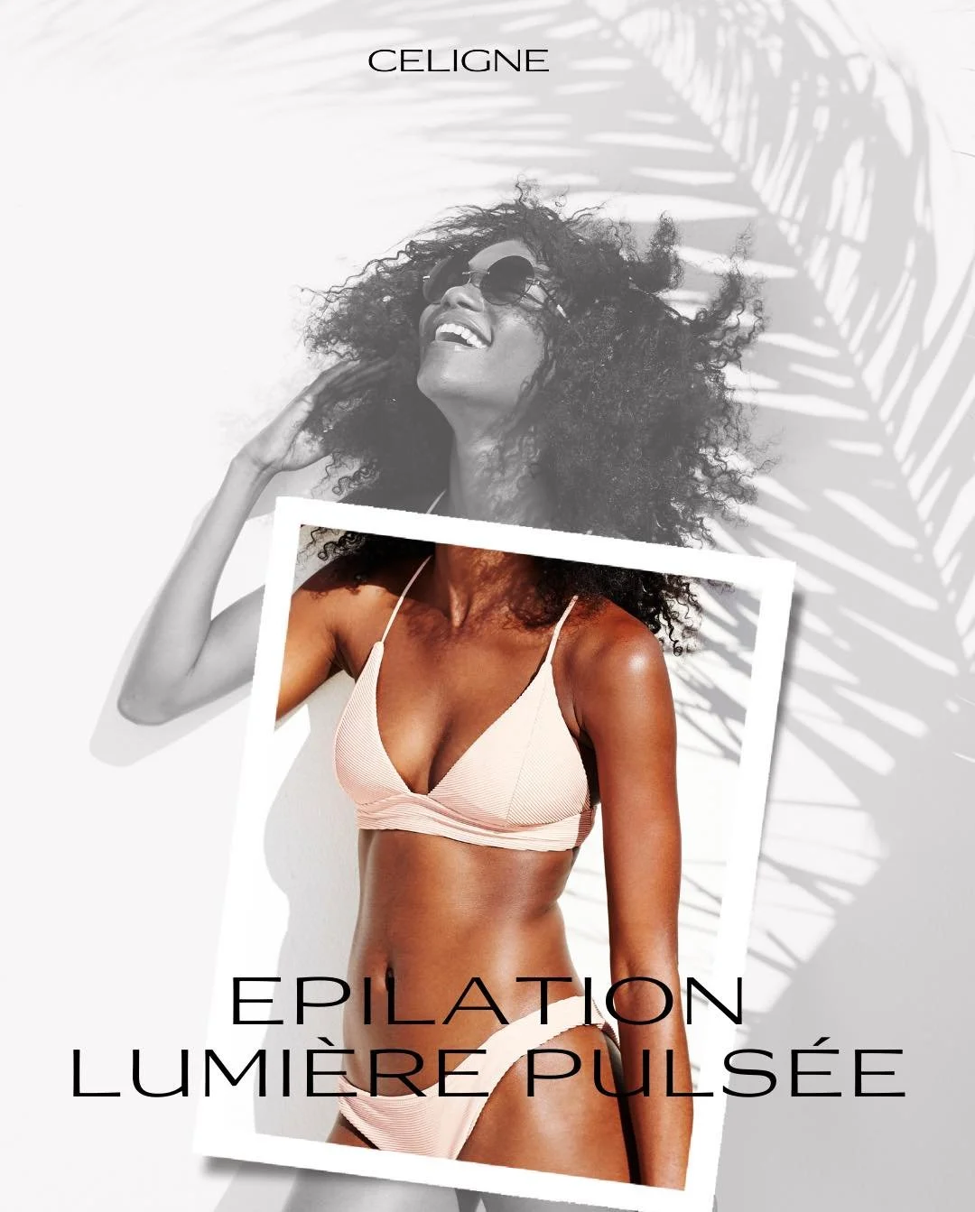 Pour de belles jambes douces tout l&rsquo;&eacute;t&eacute;, l&rsquo;&eacute;pilation d&eacute;finitive commence maintenant ! 

📞 au 03.82.34.85.82 pour prendre rdv pour un bilan &eacute;pilation d&eacute;finitive 💛

#epilationdefinitive #epilation