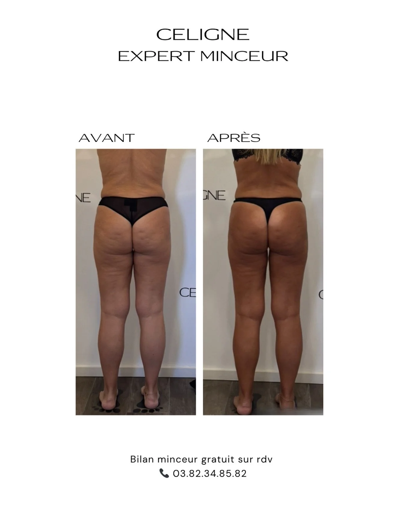 Vous r&ecirc;vez d&rsquo;une silhouette plus tonique ?
👉🏻Je veux mincir.
👉🏻Je veux me raffermir.
👉🏻Je veux des bras toniques.
Prenez soin de vous d&egrave;s aujourd&rsquo;hui chez CELIGNE.
03 82 34 85 82 - Bilan minceur gratuit !