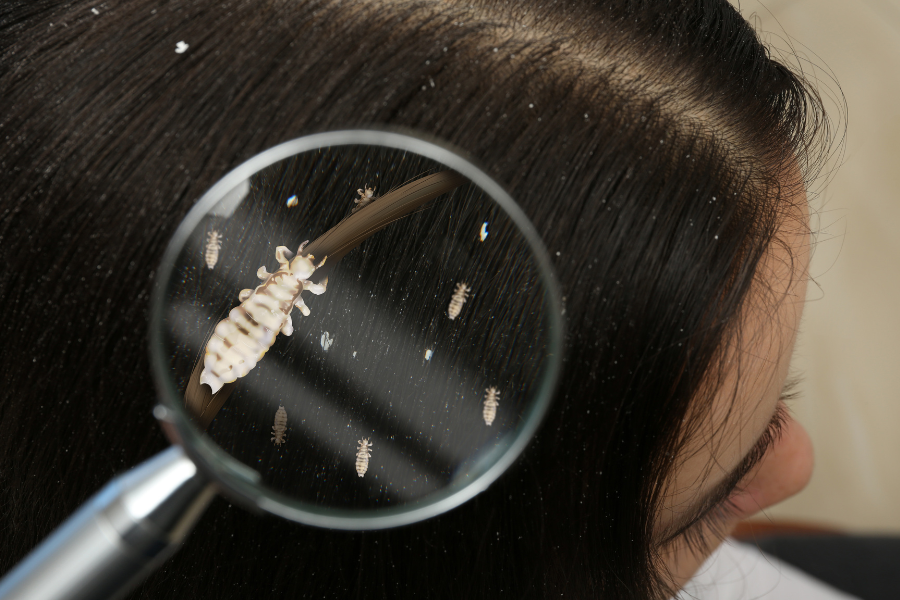 Why You Should Go To A Professional For Lice Treatment — NITWITS LICE