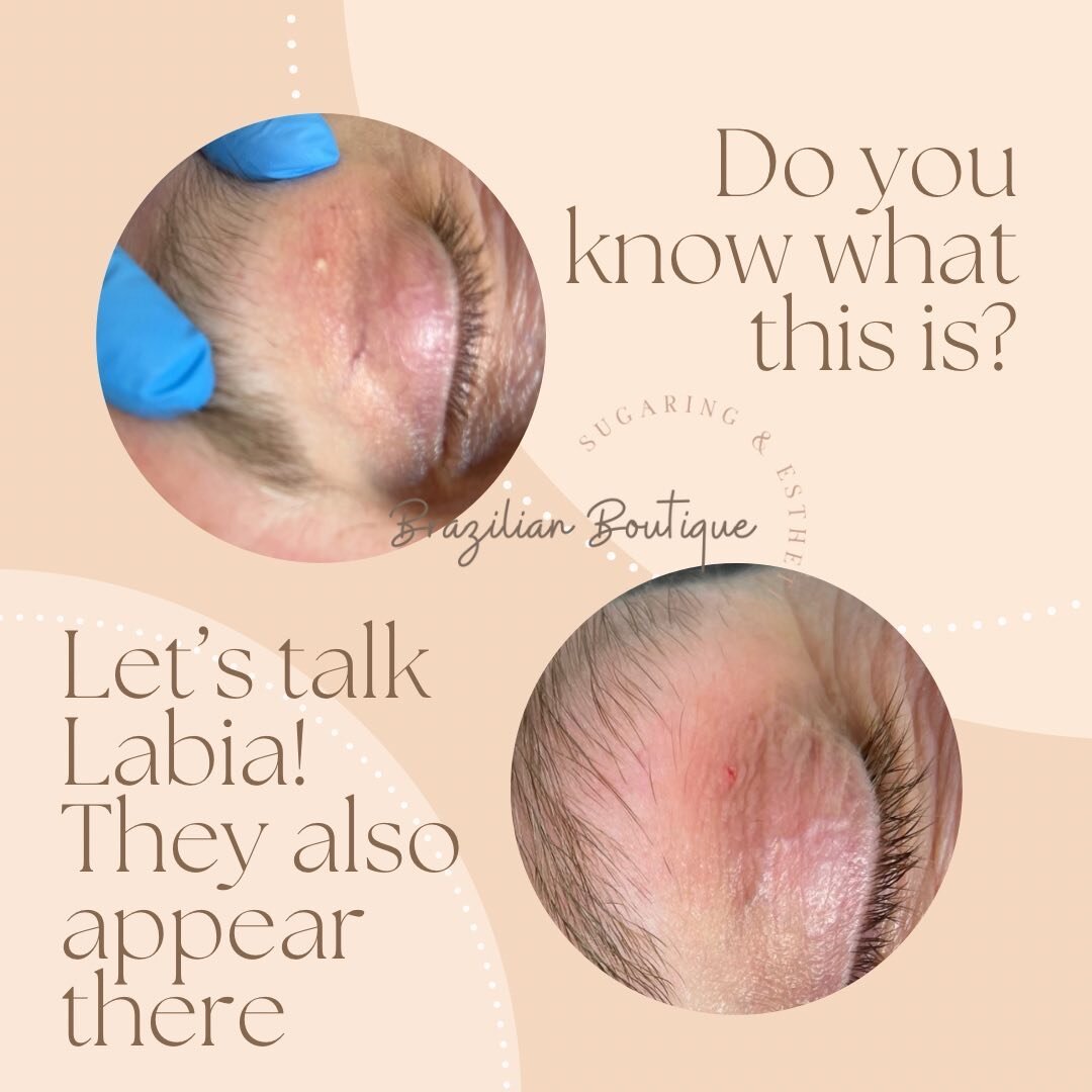 Labia MILIA or eye milia is common. 
Milia are small cysts under the skin. 

I can safely remove these for you! 

Message for appointment! 

Usually you can feel these while soaping up you lady bits. Harmless but they rarely go away on their own and 