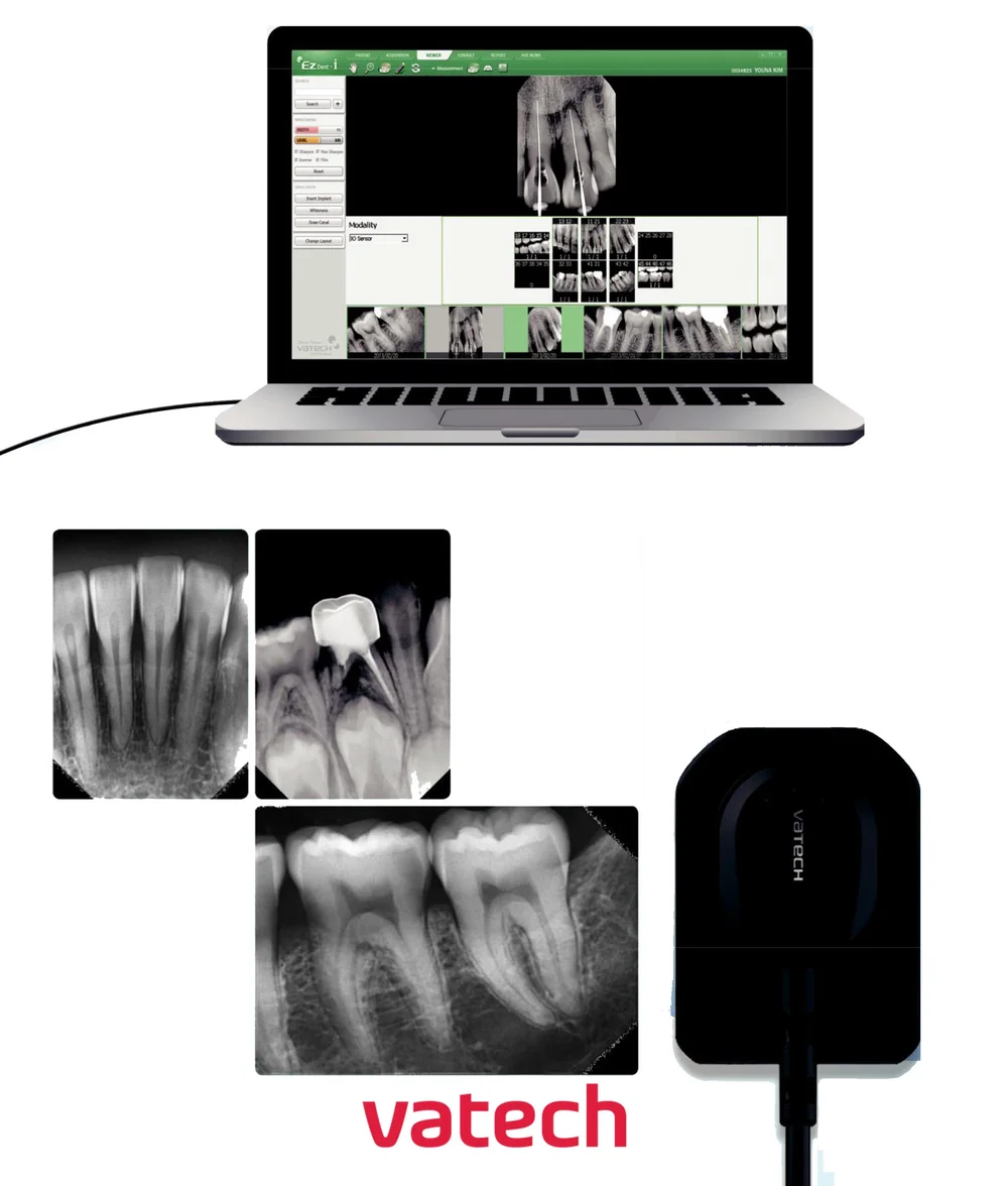 Vatech CBCT A9 | Cone Beam CT Digital untuk Klinik Gigi — PT Mandala ...