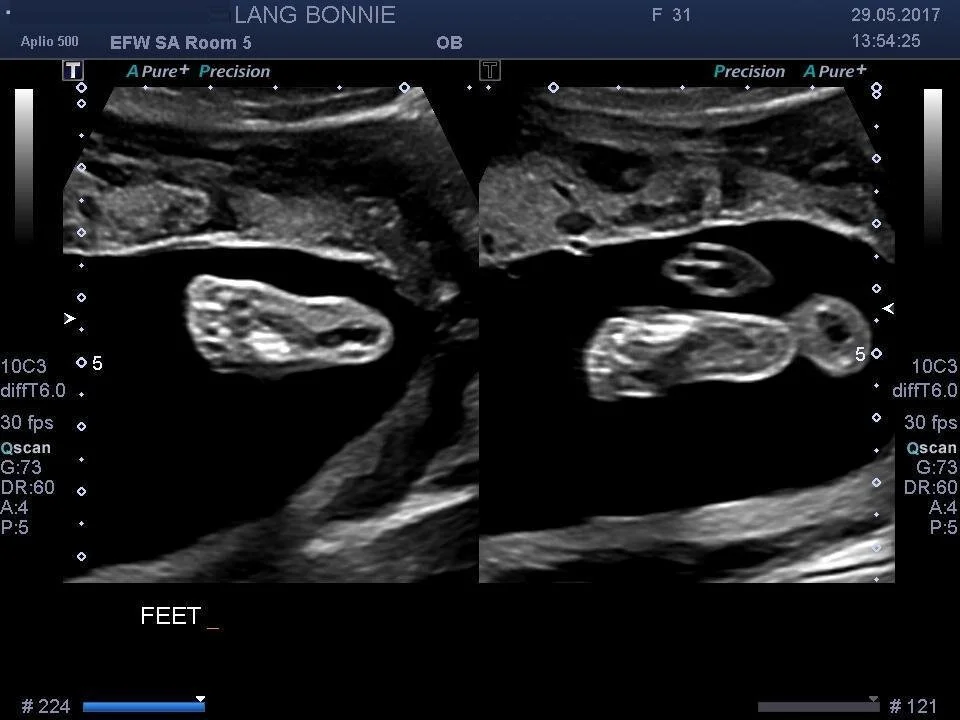 And two little feet…kicking away at the camera.