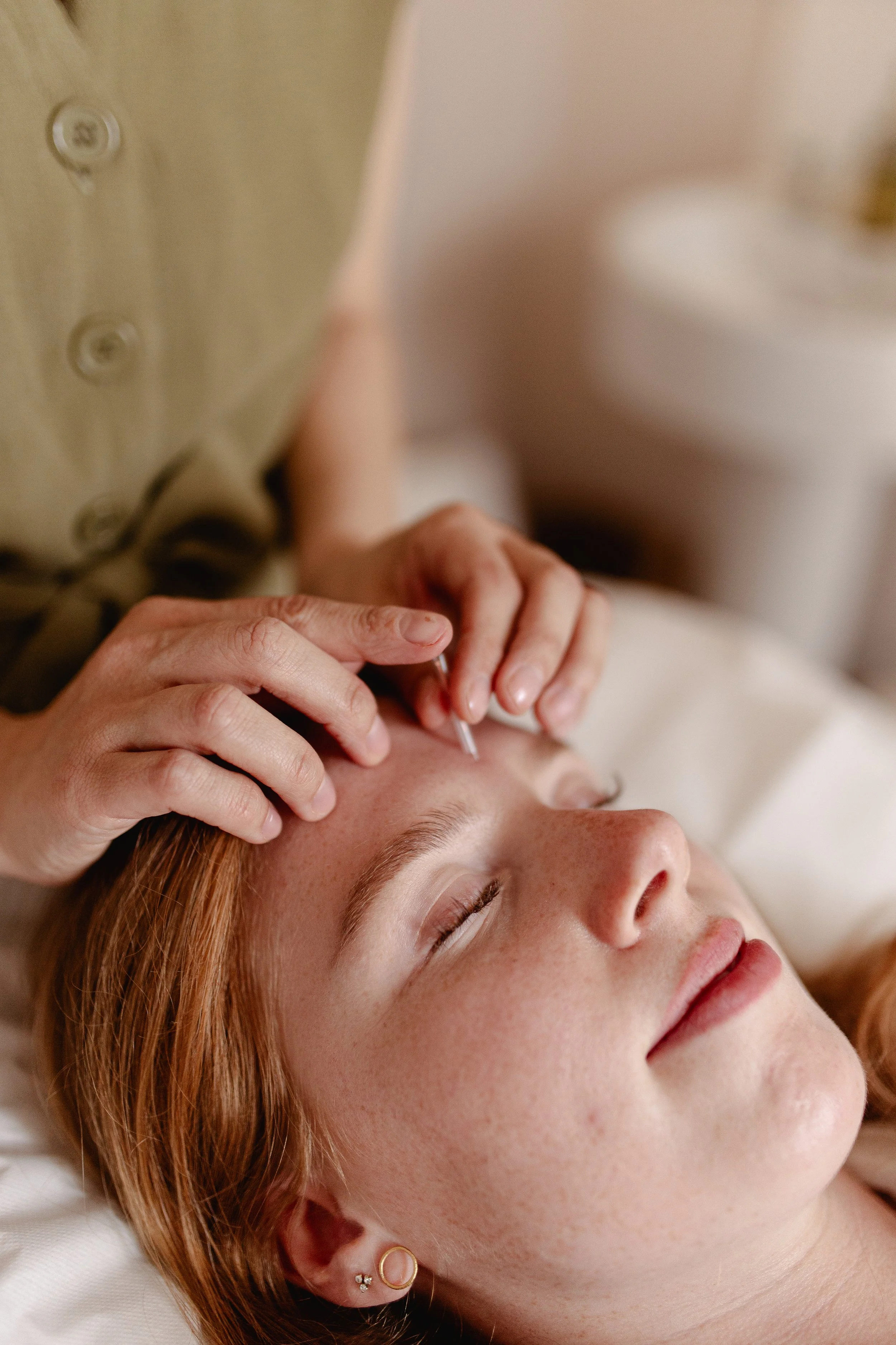 PCOS-PMOS-acupuncture-bristol.jpg