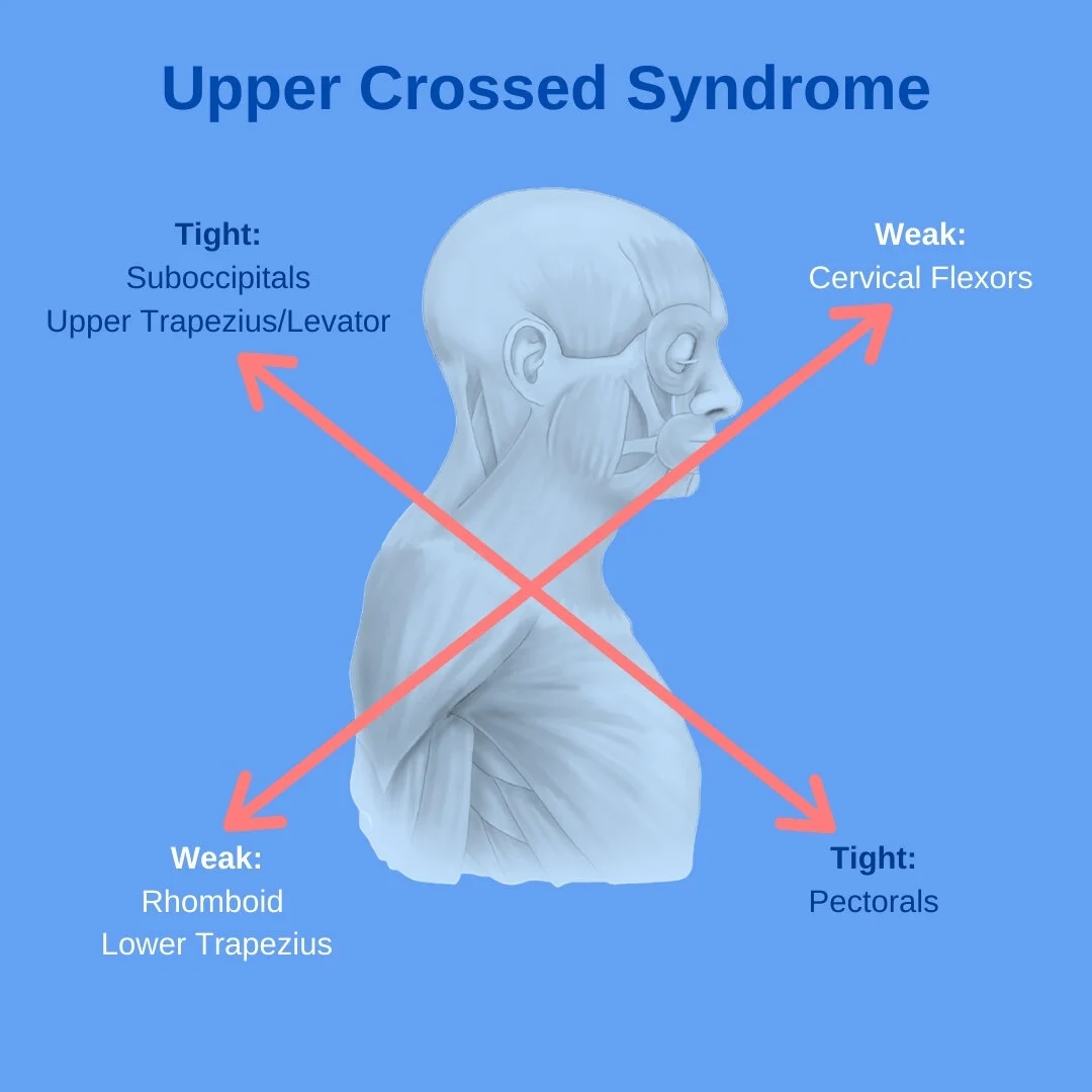Upper Crossed Syndrome