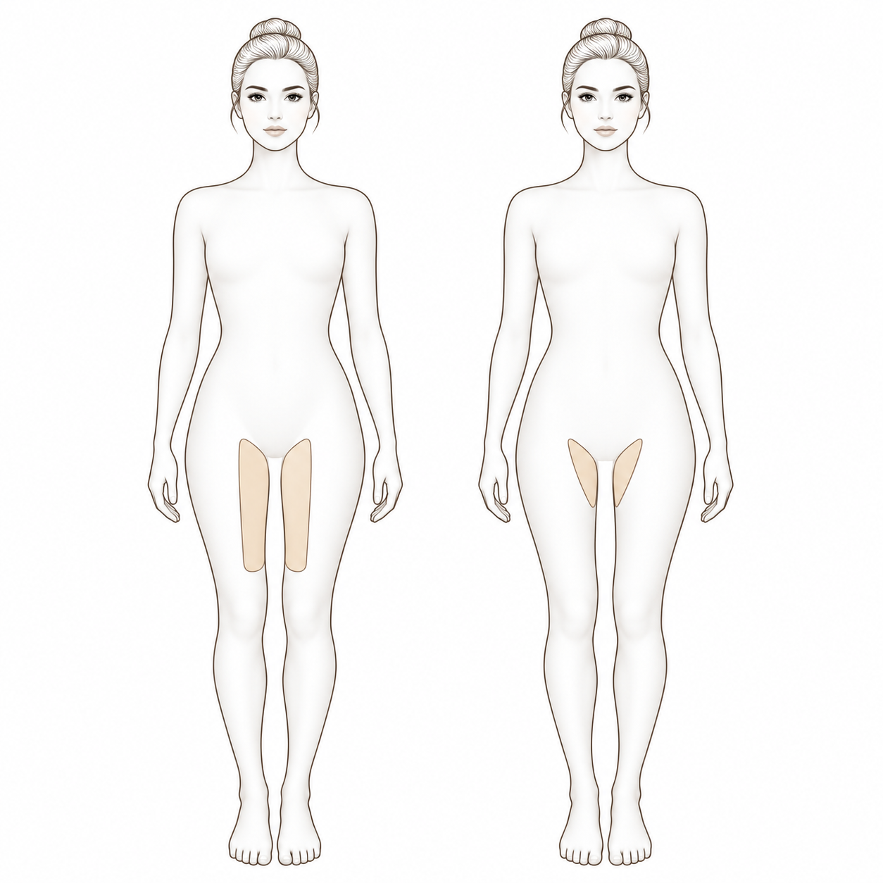 Inner Thighs