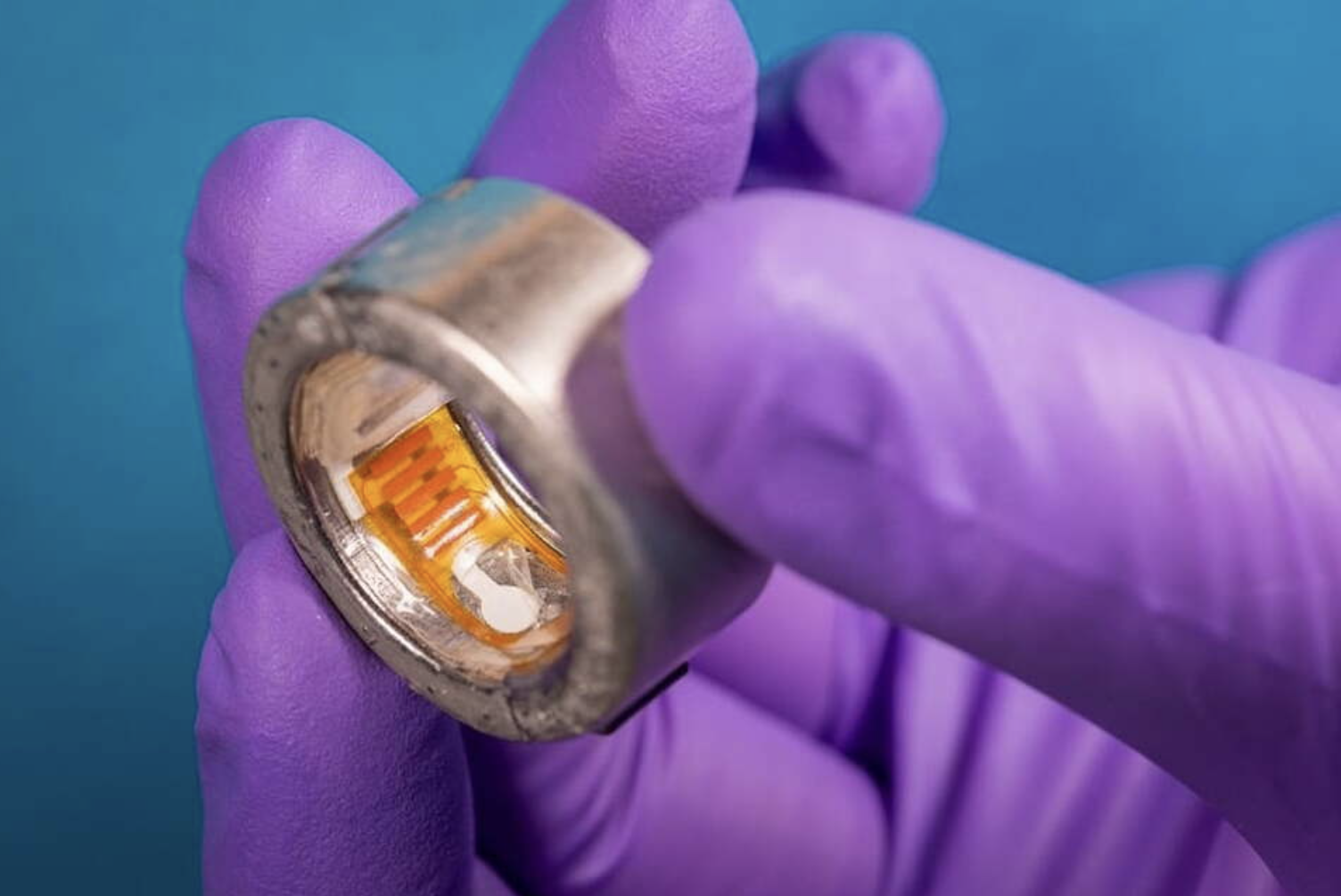 Un anillo inteligente podría ayudar a monitorear glucosa y cetonas en el futuro