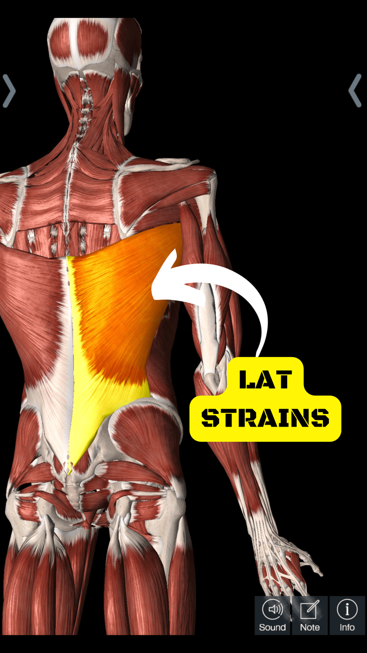 How to Handle Lat Strains in Pitchers – Armored Heat App