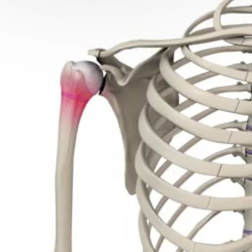 What Is Little League Shoulder? — Armored Heat