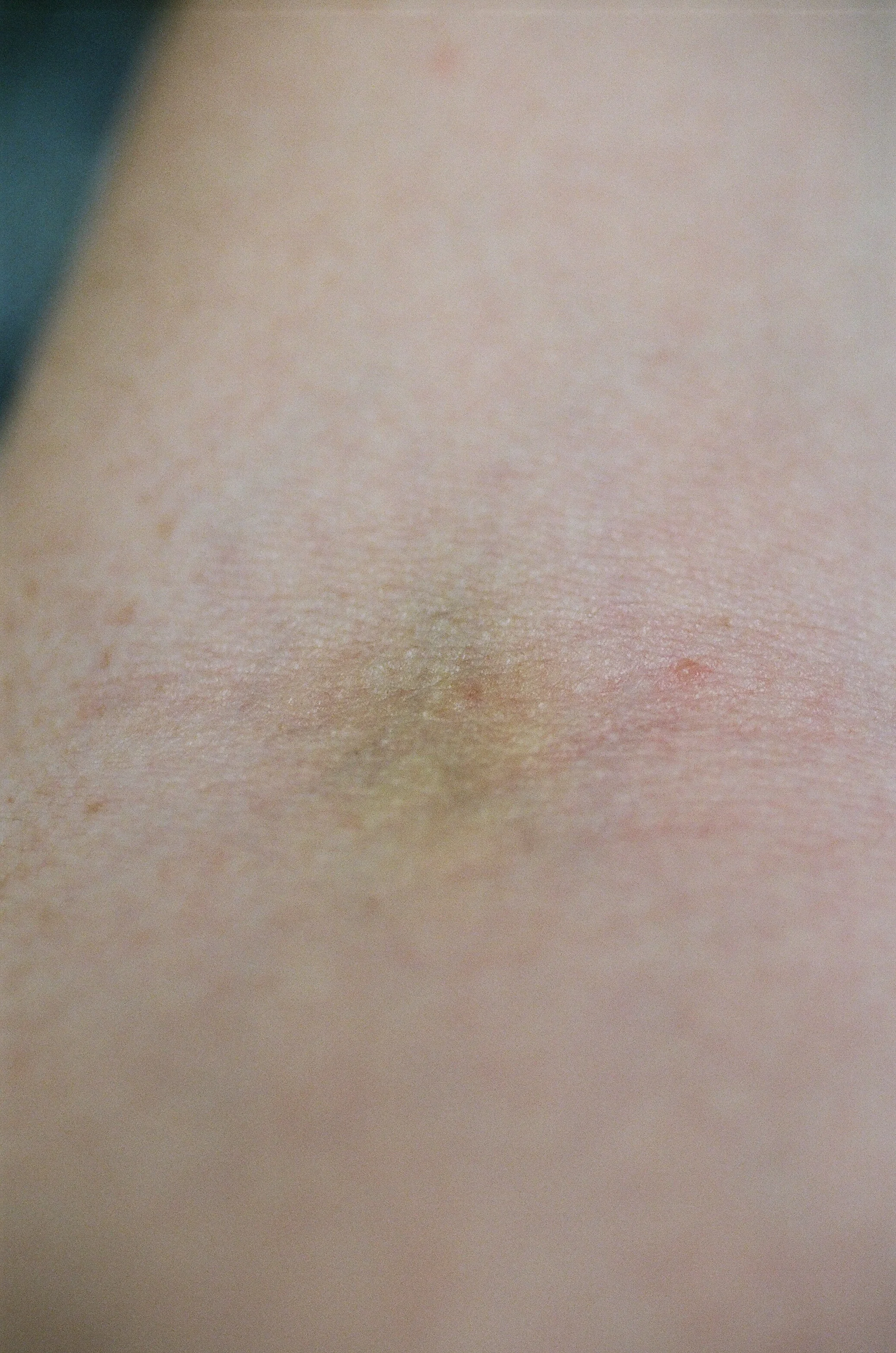 diary 2017 - 1 of 32.jpeg