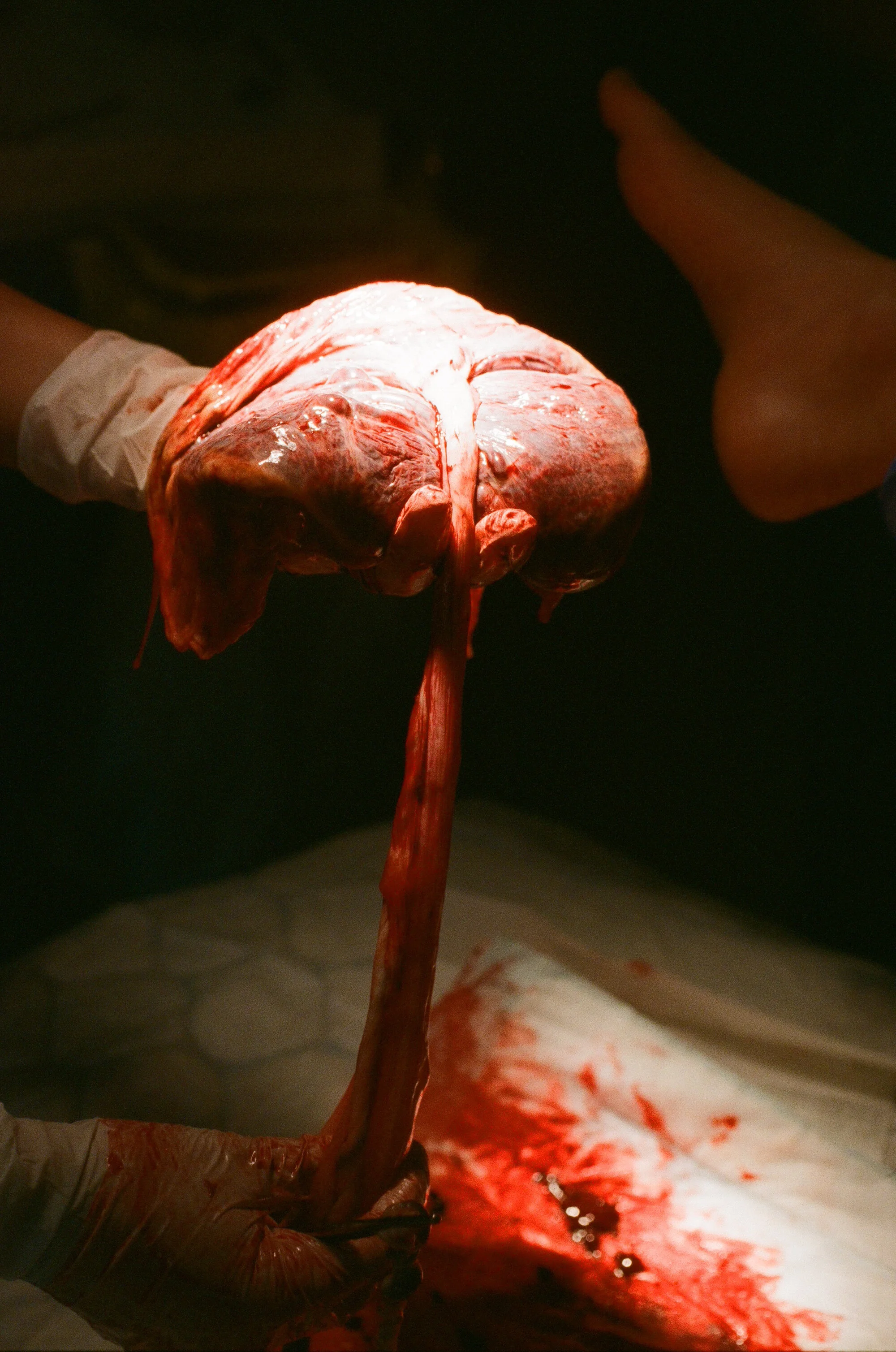 Lina_Scheynius_birth - 9 of 12.jpeg