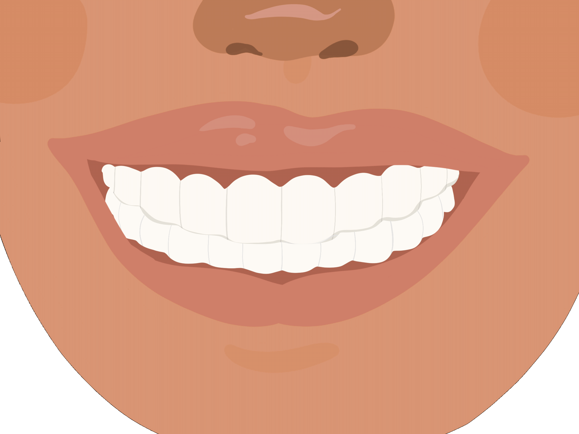 Cavities-Loop2.0.gif