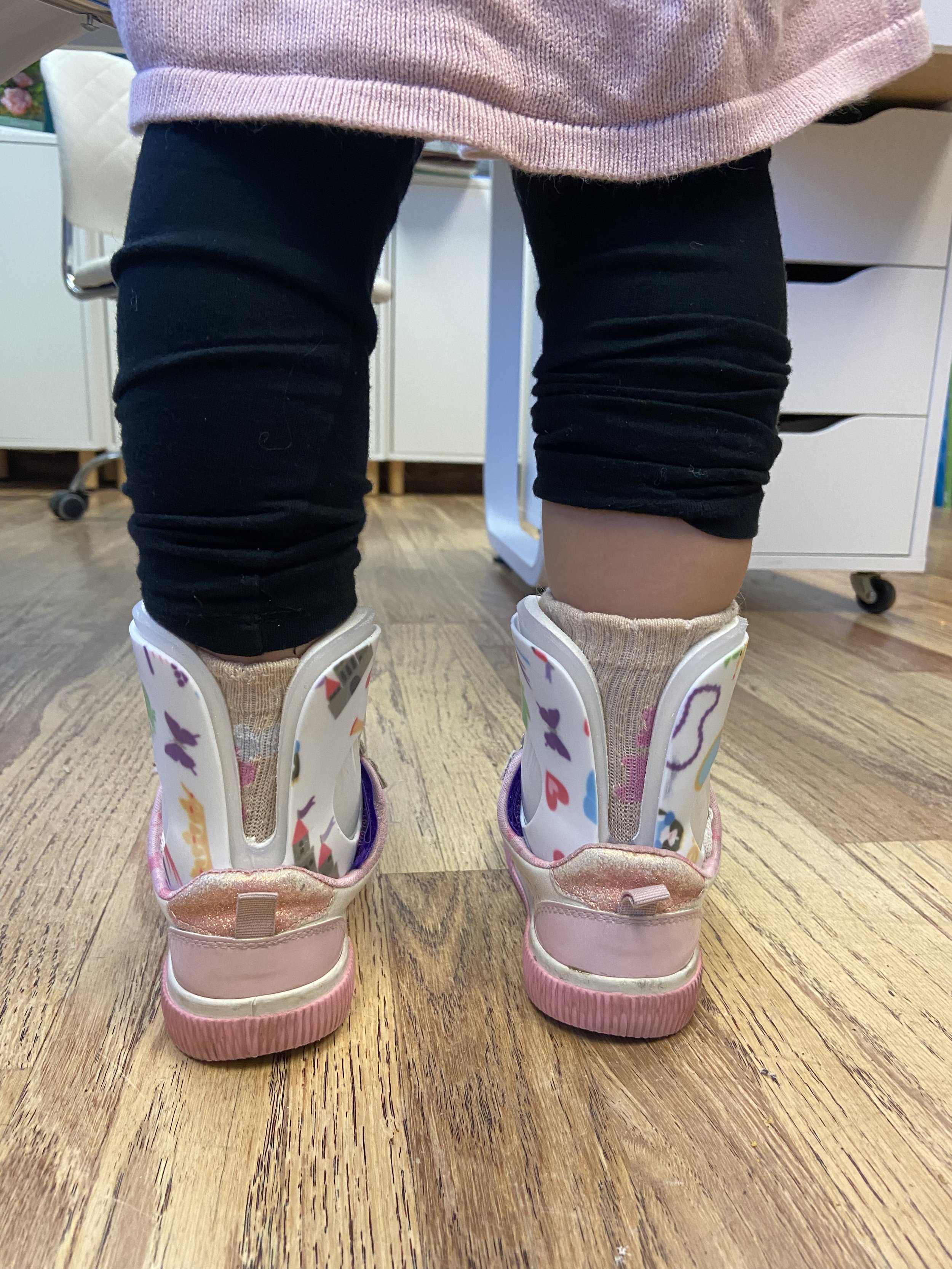 The Benefits of Custom Orthotics vs Off-the-Shelf Products