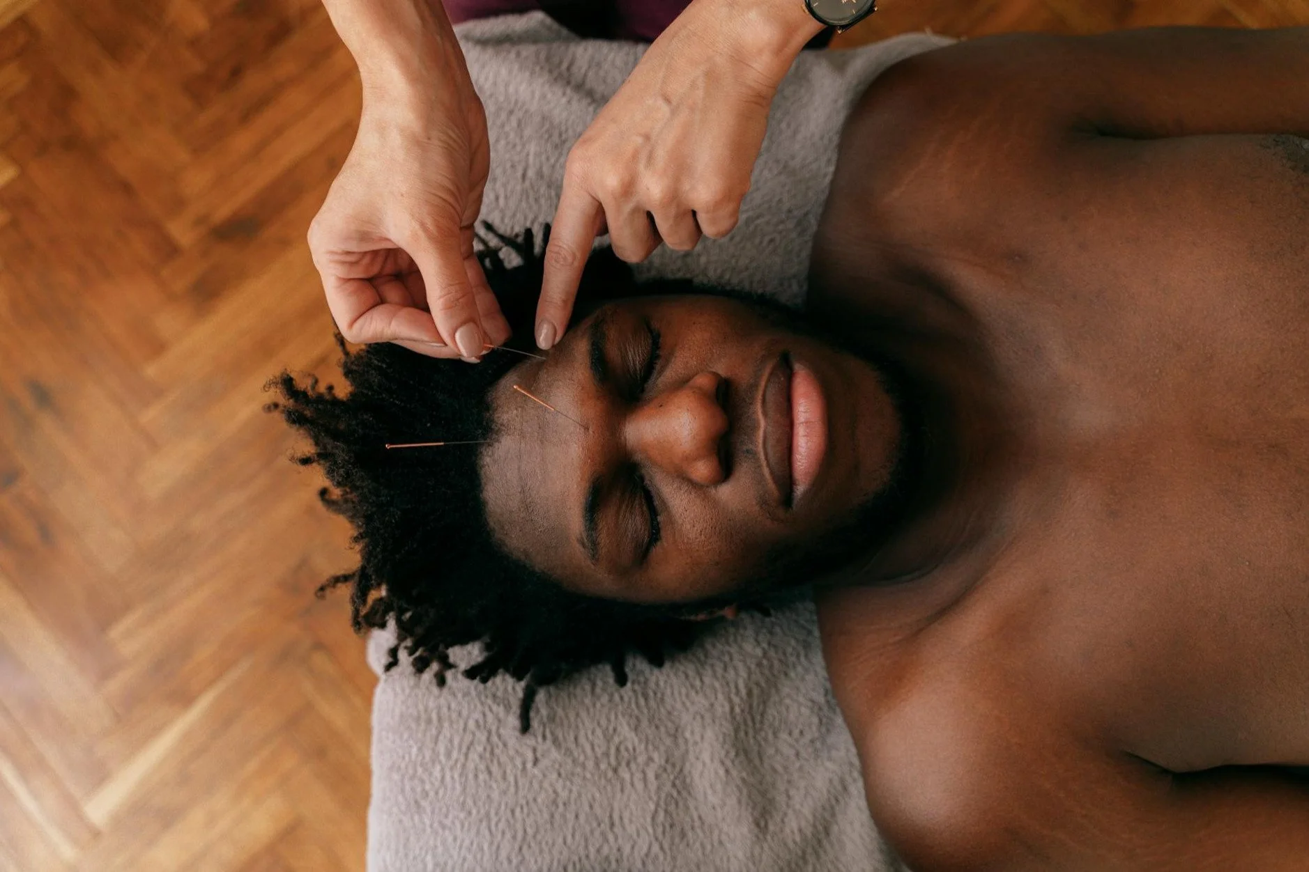 How Stress Affects Pelvic Floor Dysfunction and the Role of Acupuncture in Relief