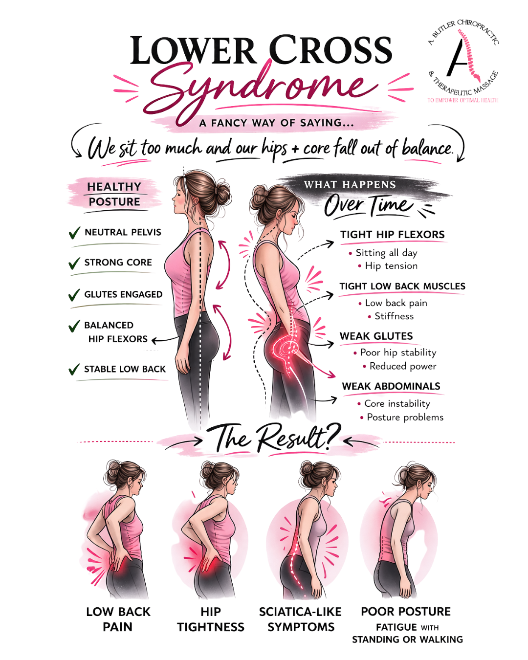 Lower Cross Syndrome: Why Sitting Too Much Can Lead to Low Back Pain, Hip Tightness, and Poor Posture